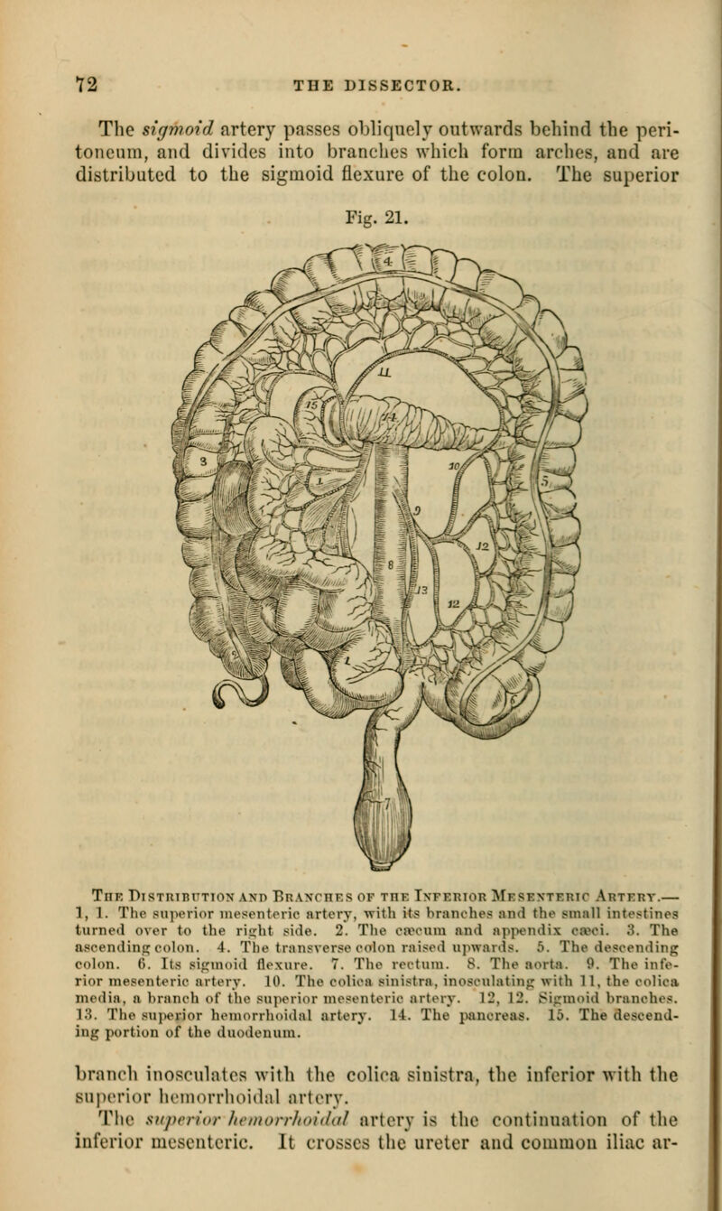 The sigmoid artery passes obliquely outwards behind the peri- toneum, and divides into branches which form arches, and are distributed to the sigmoid flexure of the colon. The superior Fig. 21. TnK DlSTRTBTTTlOX AND BrAXCHES OF THE INFERIOR MeSEKTERIC ArTERT. 1,1. The siijHM-ior mesenterie artery, with its branches and the small intestines turned over to the riirht side. 2. Tlie oivoum and apjXMidix ca^M. 3. The ascendincj colon. 4. The transverse colon raised upwards. 5. The descending colon, tj. Its sigmoid flexure. 7. The rectum. 8. The aorta. 9. The infe- rior mesenteric artery. 10. The colica sinistra, inosculating with 11, the colica media, a branch of the su]ierior mei^enterie artery. 12, 12. Sigmoid branches. LS. The siijierior hemorrhoidal artery. 14. The pancreas. 15. The descend- ing portion of the duodenum. branch inosculates with the colica sinistra, the inferior with the superior hemorrhoidal artery. Tlie superior Jiemorrhoidal artery is the continuation of the inferior mesenteric. It crosses the ureter and common iliac ar-