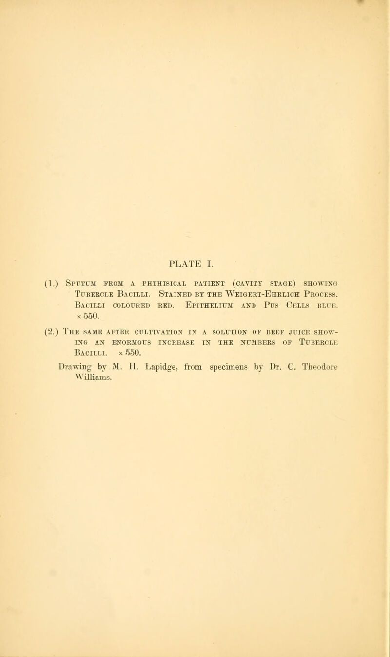 (1.) Sputum prom a phthisical patient (cavity stage) showing Tubercle Bacilli. Stained by the Weigert-Ehrlich Process. Bacilli coloured red. Epithelium and Pus Cells blue. x 550. (2.) The same after cultivation in a solution oe beef juice show- ing AN ENORMOUS INCREASE IN THE NUMBERS OF TUBERCLH Bacilli, x 550. Drawing by M. H. Lapidge, from specimens by Dr. C. Theodore Williams.