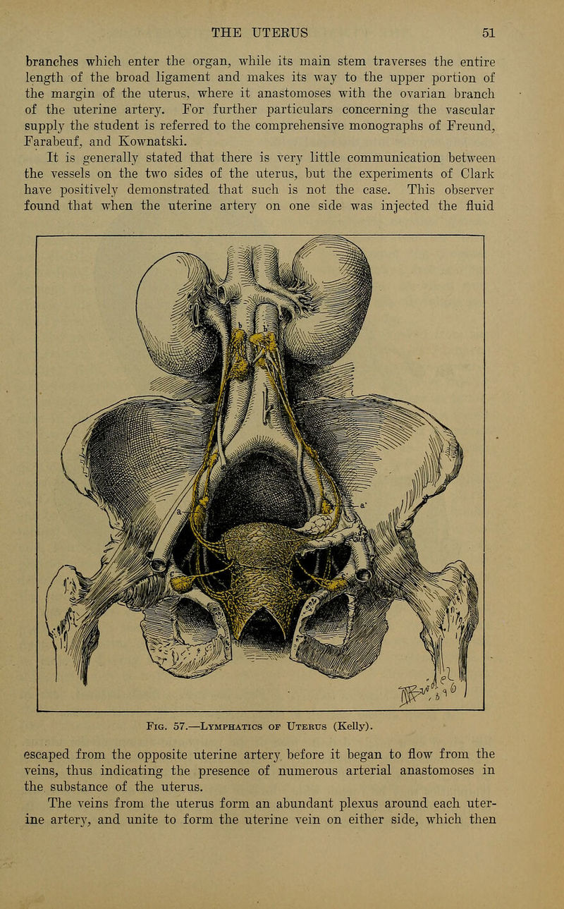 branches which enter the organ, while its main stem traverses the entire length of the broad ligament and makes its way to the upper portion of the margin of the uterus, where it anastomoses with the ovarian branch of the uterine artery. For further particulars concerning the vascular supply the student is referred to the comprehensive monographs of Freund, Farabeuf, and Kownatski. It is generally stated that there is very little communication between the vessels on the two sides of the uterus, but the experiments of Clark have positively demonstrated that such is not the case. This observer found that when the uterine artery on one side was injected the fluid Fig. 57.—Lymphatics of Uterus (Kelly). escaped from the opposite uterine artery before it began to flow from the veins, thus indicating the presence of numerous arterial anastomoses in the substance of the uterus. The veins from the uterus form an abundant plexus around each uter- ine artery, and unite to form the uterine vein on either side, which then