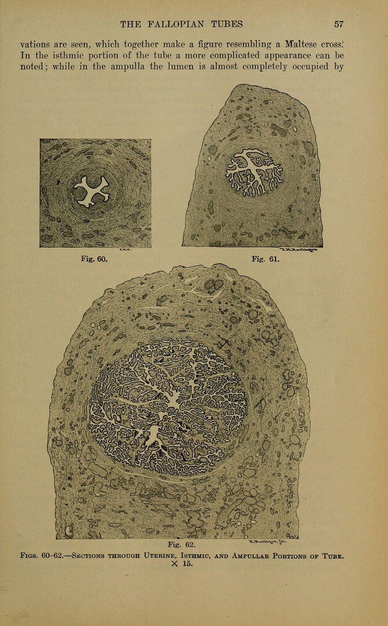 vations are seen, which together make a figure resembling a Maltese crossi In the isthmic portion of the tube a more complicated appearance can be noted; while in the ampulla the lumen is almost completely occupied by ; - <r- ■»* ■%& Fig. 60. iJiM Fig. 61. M r%J0y?* \ Fig 62_ vm**^ Figs. 60-62.—Sections through Uterine, Isthmic, and Ampullar Portions op Tube. X 15.
