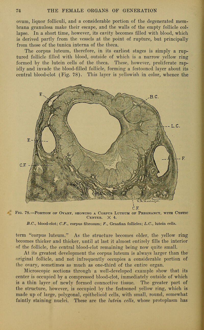 ovum, liquor folliculi, and a considerable portion of the degenerated mem- brana granulosa make their escape, and the walls of the empty follicle col- lapse. In a short time, however, its cavity becomes filled with blood, which is derived partly from the vessels at the point of rupture, but principally from those of the tunica interna of the theca. The corpus luteum, therefore, in its earliest stages is simply a rup- tured follicle filled with blood, outside of which is a narrow yellow ring formed by the lutein cells of the theca. These, however, proliferate rap- idly and invade the blood-filled follicle, forming a festooned layer about its central blood-clot (Fig. 78). This layer is yellowish in color, whence the Fig. 78.—Portion Ovary, showing a Corpus Luteum of Pregnancy, with Cystic Center. X 4. B.C., blood-clot; C.F., corpus fibrosum; F., Graafian follicles; L.C., lutein cells. term corpus luteum. As the structure becomes older, the yellow ring becomes thicker and thicker, until at last it almost entirely fills the interior of the follicle, the central blood-clot remaining being now quite small. At its greatest development the corpus luteum is always larger than the original follicle, and not infrequently occupies a considerable portion of the ovary, sometimes as much as one-third of the entire organ. Microscopic sections through a well-developed example show that its center is occupied by a compressed blood-clot, immediately outside of which is a thin layer of newly formed connective tissue. The greater part of the structure, however, is occupied by the festooned yellow ring, which is made up of large, polygonal, epithelioid cells, with small, round, somewhat faintly staining nuclei. These are the lutein cells, whose protoplasm has