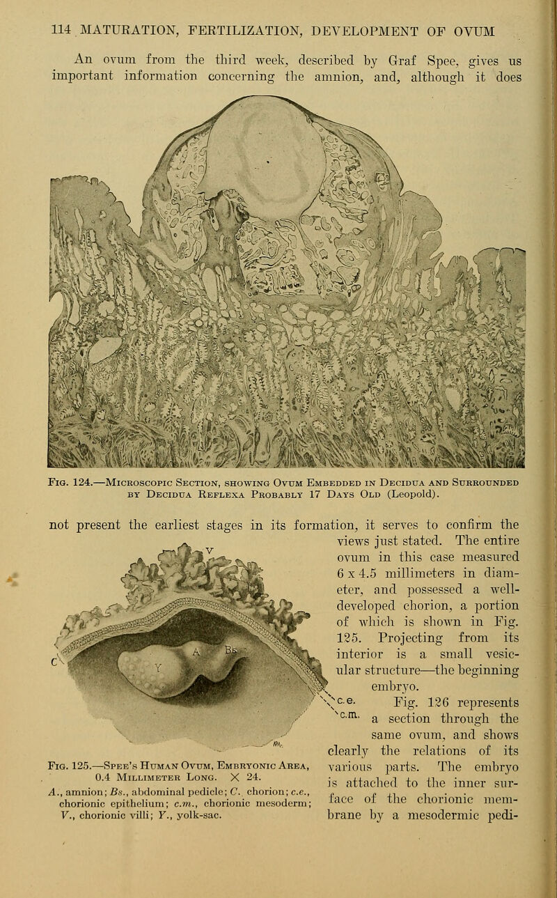 An ovum from the third week, described by Graf Spee, gives us important information concerning the amnion, and, although it does Kf**^|V ^l«^;lliii« mv»&'M*if;- 'mm Fig. 124.—Microscopic Section, showing Ovum Embedded in Decidua and Surrounded by Decidua Reflexa Probably 17 Days Old (Leopold). not present the earliest stages in its formation, it serves to confirm the views just stated. The entire ovum in this case measured 6 x 4.5 millimeters in diam- eter, and possessed a well- developed chorion, a portion of which is shown in Fig. 125. Projecting from its interior is a small vesic- ular structure—the beginning embryo. ^c.e. Y\g. 126 represents vc.m. a section through the same ovum, and shows clearly the relations of its various parts. The embryo is attached to the inner sur- face of the chorionic mem- brane by a mesodermic pedi- Fig. 125.—Spee's Human Ovum, Embryonic Area, 0.4 Millimeter Long. X 24. A., amnion; Bs., abdominal pedicle; C. chorion; c.e., chorionic epithelium; cm., chorionic mesoderm; V., chorionic villi; Y., yolk-sac.