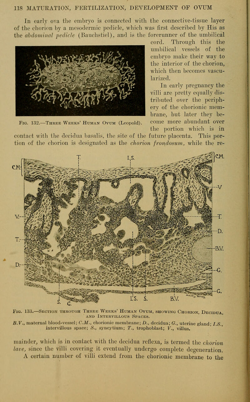 In early ova the embryo is connected with the connective-tissue layer of the chorion by a mesodermic pedicle, which was first described by His as the abdominal pedicle (Bauehstiel), and is the forerunner of the umbilical cord. Through this the umbilical vessels of the embryo make their way to the interior of the chorion, which then becomes vascu- larized. In early pregnancy the villi are pretty equally dis- tributed over the periph- ery of the chorionic mem- brane, but later they be- come more abundant over the portion which is in contact with the decidua basalis, the site of the future placenta. This por- tion of the chorion is designated as the chorion frondosum, while the re- Fig. 132.—Three Weeks' Human Ovum (Leopold). LS. ^V-1 CM. imim *4--G. r*Ef&m i:s. s. b.v. J ^ Fig. 133.—Section through T B.V Weeks' Human Ovum, Intervillous Spaces. >wing Chorion, Decidua, , maternal blood-vessel; CM., chorionic membrane; D., decidua; G., uterine gland; I.S., intervillous space; S., syncytium; T., trophoblast; V., villus. mainder, which is in contact with the decidua reflexa, is termed the chorion lave, since the villi covering it eventually undergo complete degeneration. A certain number of villi extend from the chorionic membrane to the