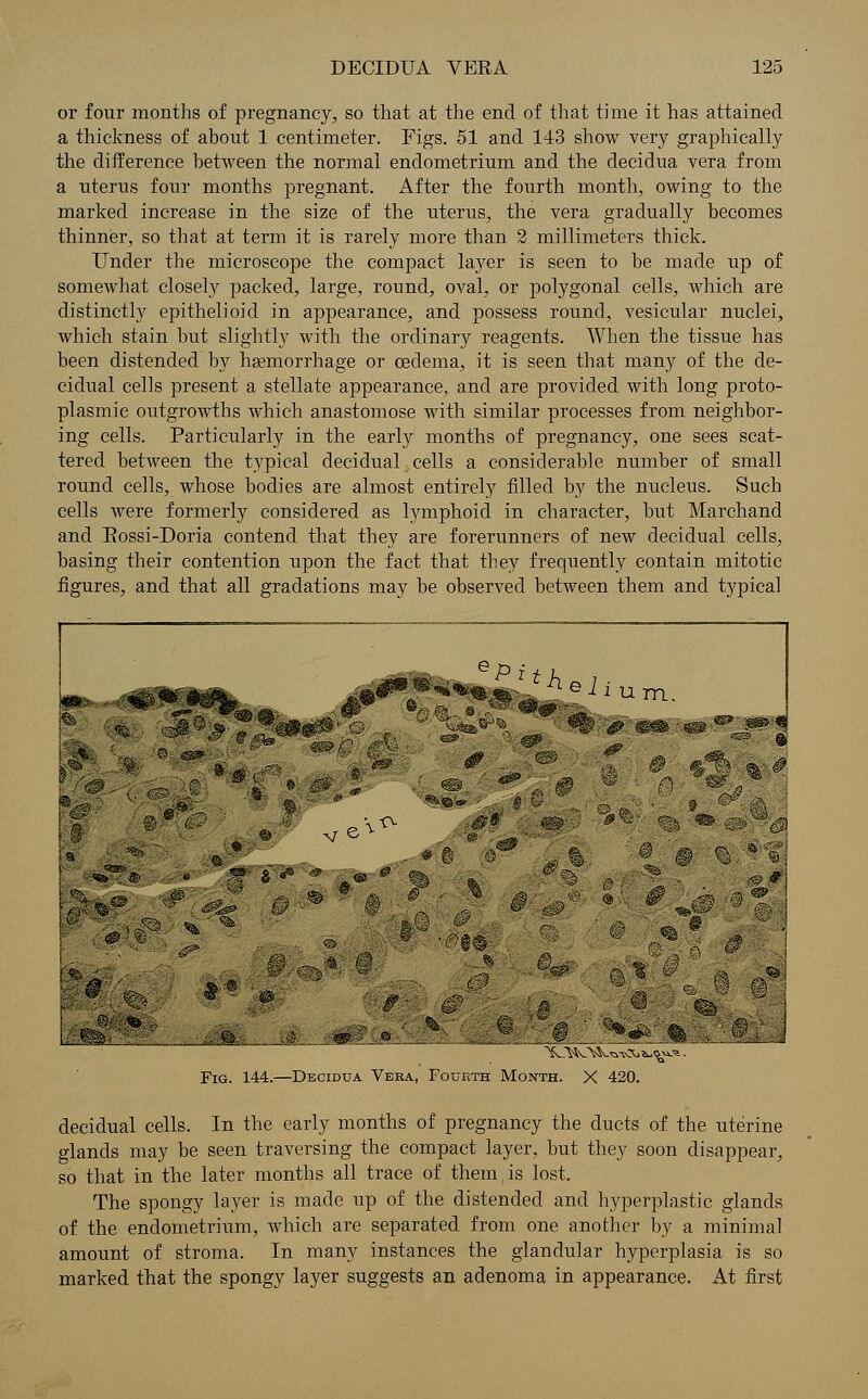 or four months of pregnancy, so that at the end of that time it has attained a thickness of about 1 centimeter. Figs. 51 and 143 show very graphically the difference between the normal endometrium and the decidua vera from a uterus four months pregnant. After the fourth month, owing to the marked increase in the size of the uterus, the vera gradually becomes thinner, so that at term it is rarely more than 2 millimeters thick. Under the microscope the compact layer is seen to be made up of somewhat closely packed, large, round, oval, or polygonal cells, which are distinctly epithelioid in appearance, and possess round, vesicular nuclei, which stain but slightly with the ordinary reagents. When the tissue has been distended by haemorrhage or oedema, it is seen that many of the de- cidual cells present a stellate appearance, and are provided with long proto- plasmic outgrowths which anastomose with similar processes from neighbor- ing cells. Particularly in the early months of pregnancy, one sees scat- tered between the typical decidual cells a considerable number of small round cells, whose bodies are almost entirely filled by the nucleus. Such cells were formerly considered as lymphoid in character, but Marchand and Eossi-Doria contend that they are forerunners of new decidual cells, basing their contention upon the fact that they frequently contain mitotic figures, and that all gradations may be observed between them and typical $■■: '« 'a'.*,- =•- ^ . dv ^ ^ ~m^ ^ &■■■*■'&'•■■.'-&:* .: <® ■■':'*?''& '^ ''' ®^ ' .'- *&©«. ;- 3 '* was8 bc tig ~ -. *■-' , ^«y- ''■' ' i -,rc ^' * # 5 ' « @ ' 0 ' •■£' _ . o ~ ': |M§ (% -1 /f f*..■'... ''' 2S: 8 IP ' %£ a 1 _ a 5fe ; # % .....@. ._ia .wL^::l % :;f i.^«^;%V:@iJ Fig. 144.—Decidua Vera, Fourth Month. X 420. decidual cells. In the early months of pregnancy the ducts of the uterine glands may be seen traversing the compact layer, but they soon disappear, so that in the later months all trace of them is lost. The spongy layer is made up of the distended and hyperplastic glands of the endometrium, which are separated from one another by a minimal amount of stroma. In many instances the glandular hyperplasia is so marked that the spongy layer suggests an adenoma in appearance. At first