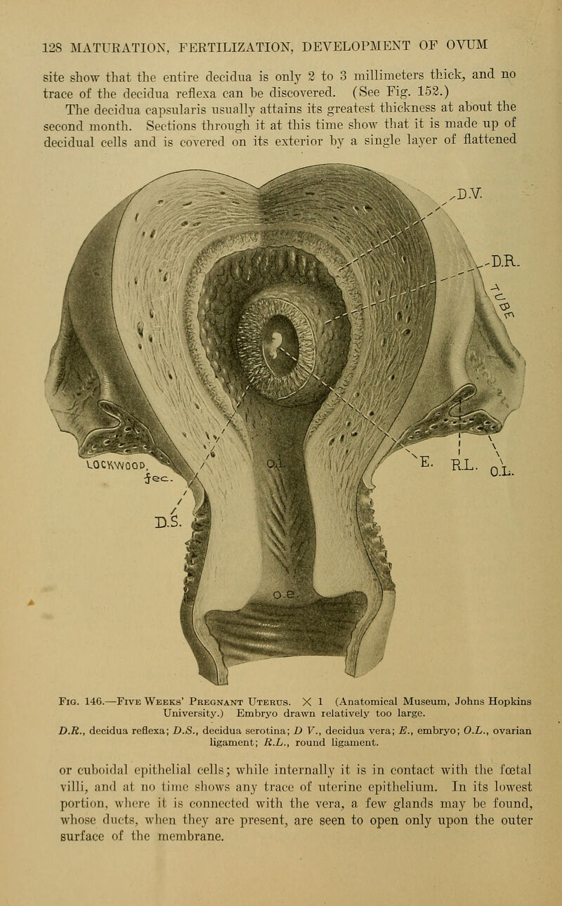 site show that the entire decidua is only 2 to 3 millimeters thick, and no trace of the decidua reflexa can he discovered. (See Fig. 152.) The decidua capsularis usually attains its greatest thickness at about the second month. Sections through it at this time show that it is made up of decidual cells and is covered on its exterior by a single layer of flattened -D.R. Fig. 146.—Five Weeks' Pregnant Uterus. X 1 (Anatomical Museum, Johns Hopkins University.) Embryo drawn relatively too large. D.R., decidua reflexa; D.S., decidua serotina; D V., decidua vera; E., embryo; O.L., ovarian ligament; R.L., round ligament. or euboidal epithelial cells; while internally it is in contact with the foetal villi, and nl no time shows any trace of uterine epithelium. In its lowest portion, where it is connected with the vera, a few glands may be found, whose ducts, when they are present, are seen to open only upon the outer surface of the membrane.