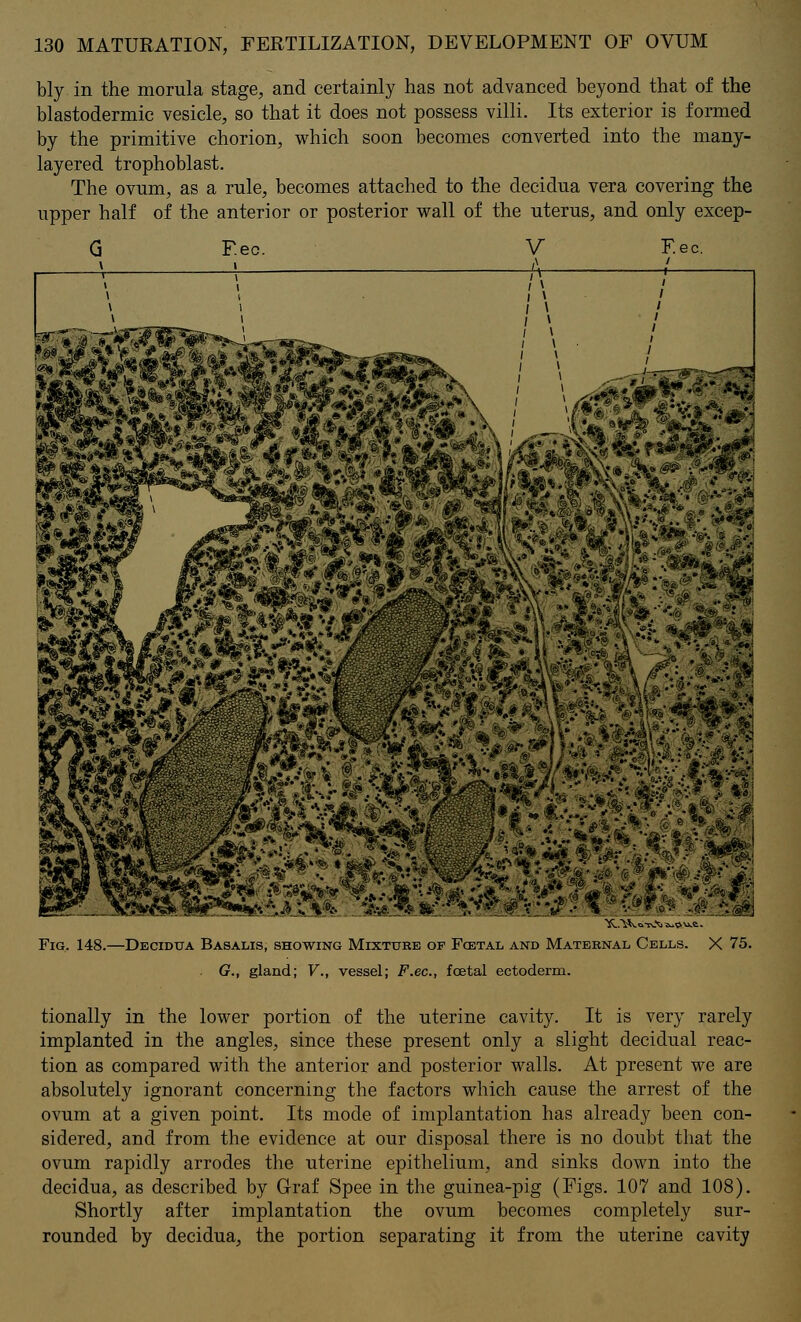 bly in the morula stage, and certainly has not advanced beyond that of the blastodermic vesicle, so that it does not possess villi. Its exterior is formed by the primitive chorion, which soon becomes converted into the many- layered trophoblast. The ovum, as a rule, becomes attached to the decidua vera covering the upper half of the anterior or posterior wall of the uterus, and only excep- Q F.ec. V F.ec. Fig. 148.—Decidua Basalis, showing Mixtuhe of Fcetal and Maternal Cells. X 75. G., gland; V., vessel; F.ec, foetal ectoderm. tionally in the lower portion of the uterine cavity. It is very rarely implanted in the angles, since these present only a slight decidual reac- tion as compared with the anterior and posterior walls. At present we are absolutely ignorant concerning the factors which cause the arrest of the ovum at a given point. Its mode of implantation has already been con- sidered, and from the evidence at our disposal there is no doubt that the ovum rapidly arrodes the uterine epithelium, and sinks clown into the decidua, as described by Graf Spee in the guinea-pig (Figs. 107 and 108). Shortly after implantation the ovum becomes completely sur- rounded by decidua, the portion separating it from the uterine cavity