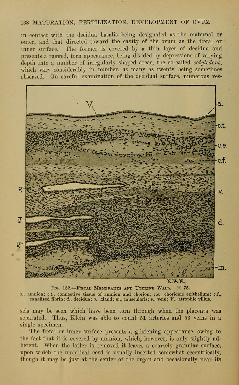 in contact with the decidua basalis being designated as the maternal or outer, and that directed toward the cavity of the ovum as. the fcetal or inner surface. The former is covered by a thin layer of decidua and presents a ragged, torn appearance, being divided by depressions of varying depth into a number of irregularly shaped areas, the so-called cotyledons, which vary considerably in number, as many as twenty being sometimes observed. On careful examination of the decidual surface, numerous ves- Fig. 152.-—Foetal Membranes and Uterine Wall. X 75. a., amnion; c.t., connective tissue of amnion and chorion; c.e., chorionic epithelium; c./., canalized fibrin; d., decidua; g., gland; m., muscularis; v., vein; V., atrophic villus. sels may be seen which have been torn through when the placenta was separated. Thus, Klein was able to count 51 arteries and 53 veins in a single specimen. The foetal or inner surface presents a glistening appearance, owing to the fact that it is covered by amnion, which, however, is only slightly ad- herent. When the latter is removed it leaves a coarsely granular surface, upon which the umbilical cord is usually inserted somewhat eccentrically, though it may be just at the center of the organ and occasionally near its-