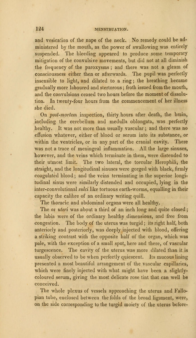 and vesication of the nape of the neck. No remedy could be ad- ministered by the mouth, as the power of swallowing was entirely suspended. The bleeding appeared to produce some temporary mitigation of the convulsive movements, but did not at all diminish the frequency of the paroxysms ; and there was not a gleam of consciousness either then or afterwards. The pupil was perfectly insensible to light, and dilated to a ring; the breathing became gradually more laboured and stertorous; froth issued from the mouth, and the convulsions ceased two hours before the moment of dissolu- tion. In twenty-four hours from the commencement of her illness she died. On post-mortem inspection, thirty hours after death, the brain, including the cerebellum and medulla oblongata, was perfectly healthy. It was not more than usually vascular ; and there was no effusion whatever, either of blood or serum into its substance, or within the ventricles, or in any part of the cranial cavity. There was not a trace of meningeal inflammation. All the large sinuses, however, and the veins which terminate in them, were distended to their utmost limit. The two lateral, the torcular Herophili, the straight, and the longitudinal sinuses were gorged with black, firmly coagulated blood; and the veins terminating in the superior longi- tudinal sinus were similarly distended and occupied, lying in the inter-convolutional sulci like tortuous earth-worms, equalling in their capacity the calibre of an ordinary writing quill. The thoracic and abdominal organs were all healthy. The os uteri was about a third of an inch long and quite closed; the labia were of the ordinary healthy dimensions, and free from congestion. The body of the uterus was turgid; its right half, both anteriorly and posteriorly, was deeply injected with blood, offering a striking contrast with the opposite half of the organ, which was pale, with the exception of a small spot, here and there, of vascular turgescence. The cavity of the uterus was more dilated than it is usually observed to be when perfectly quiescent. Its mucous lining presented a most beautiful arrangement of the vascular capillaries, which were finely injected with what might have been a slightty- coloured serum, giving the most delicate rose tint that can well be conceived. The whole plexus of vessels approaching the uterus and Fallo- pian tube, enclosed between the folds of the broad ligament, were, on the side corresponding to the turgid moiety of the uterus before-