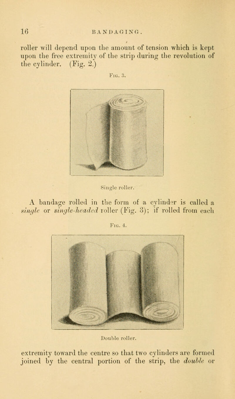 roller will depend upon the amount of tension which is kept upon the free extremity of the strip during the revolution of the cylinder. (Fig. 2.) Fig. 3. Single roller A bandage rolled in the form of a cylinder is called a single or single-headed roller (Fig. 3); if rolled from each Fig. 4. Double roller. extremity toward the centre so that two cylinders are formed joined by the central portion of the strip, the double or