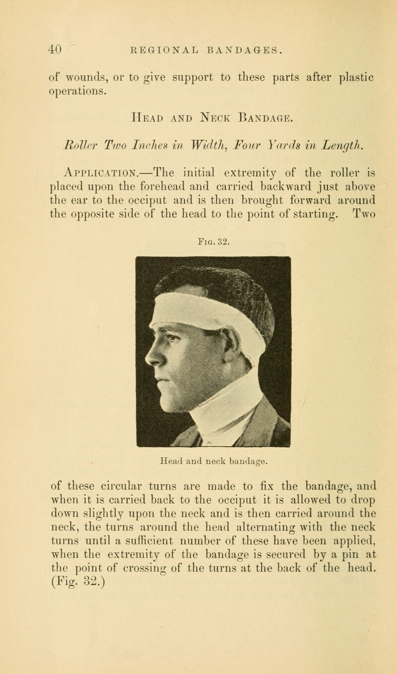 of wounds, or to give support to these parts after plastic operations. Head and Neck Bandage. Roller Two Inches in Width, Four Yards in Length. Application.—The initial extremity of the roller is placed upon the forehead and carried backward just above the ear to the occiput and is then brought forward around the opposite side of the head to the point of starting. Two Fig. 32. Head and neck bandage. of these circular turns are made to fix the bandage, and when it is carried back to the occiput it is allowed to drop down slightly upon the neck and is then carried around the neck, the turns around the head alternating with the neck turns until a sufficient number of these have been applied, when the extremity of the bandage is secured by a pin at the point of crossing of the turns at the back of the head. (Fig. 32.)