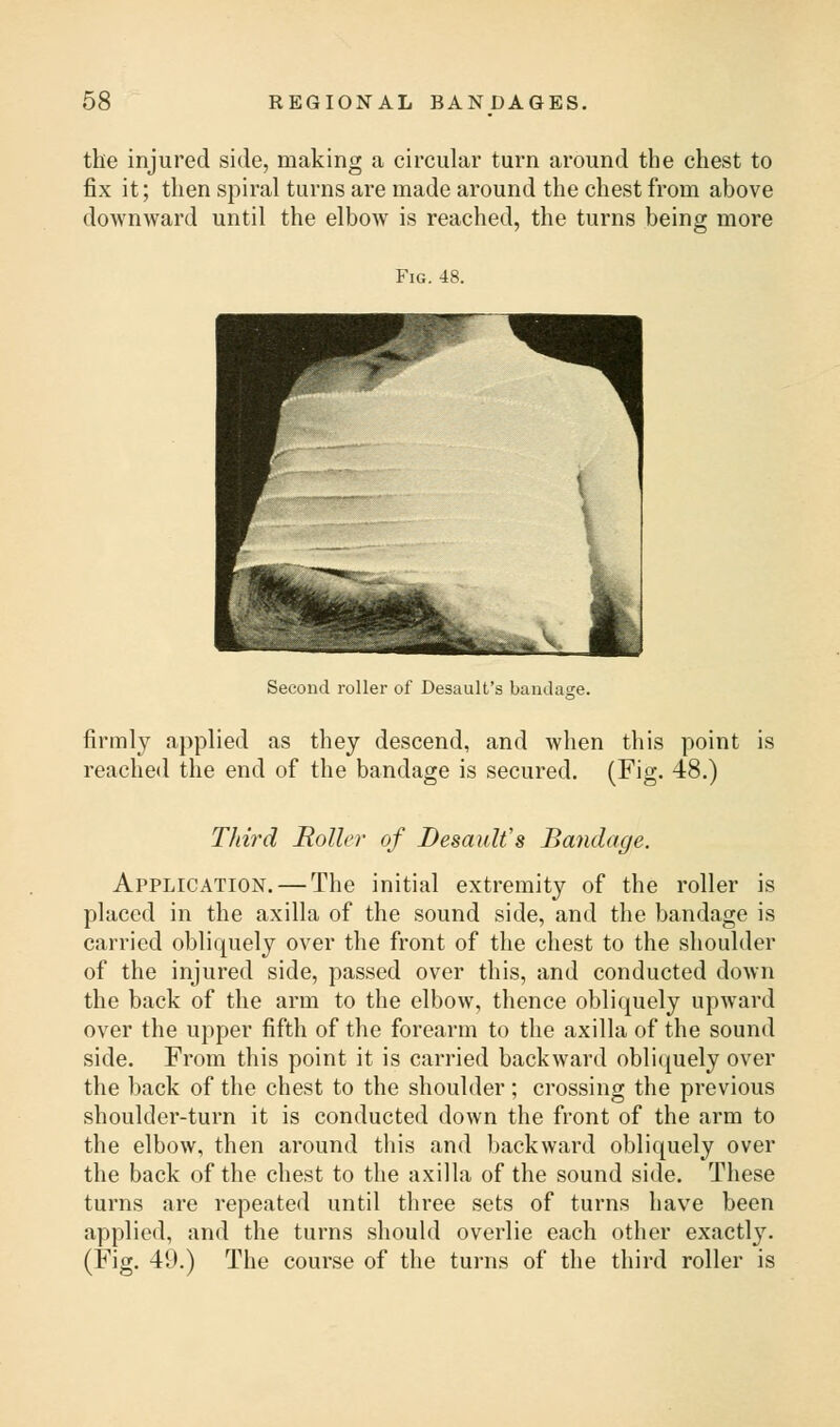 the injured side, making a circular turn around the chest to fix it; then spiral turns are made around the chest from above downward until the elbow is reached, the turns being more Fig. 48. Second roller of Desault's bandage. firmly applied as they descend, and when this point is reached the end of the bandage is secured. (Fig. 48.) Third Roller of Desault's Bandage. Application. — The initial extremity of the roller is placed in the axilla of the sound side, and the bandage is carried obliquely over the front of the chest to the shoulder of the injured side, passed over this, and conducted down the back of the arm to the elbow, thence obliquely upward over the upper fifth of the forearm to the axilla of the sound side. From this point it is carried backward obliquely over the back of the chest to the shoulder; crossing the previous shoulder-turn it is conducted down the front of the arm to the elbow, then around this and backward obliquely over the back of the chest to the axilla of the sound side. These turns are repeated until three sets of turns have been applied, and the turns should overlie each other exactly. (Fig. 49.) The course of the turns of the third roller is