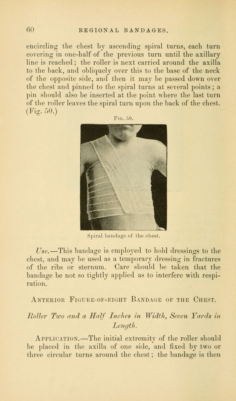 encircling the chest by ascending spiral turns, each turn covering in one-half of the previous turn until the axillary line is reached; the roller is next carried around the axilla to the back, and obliquely over this to the base of the neck of the opposite side, and then it may be passed down over the chest and pinned to the spiral turns at several points; a pin should also be inserted at the point where the last turn of the roller leaves the spiral turn upon the back of the chest. (Fig. 50.) Fig. 50. Spiral bandage of the chest. Use.—This bandage is employed to hold dressings to the chest, and may be used as a temporary dressing in fractures of the ribs or sternum. Care should be taken that the bandage be not so tightly applied as to interfere with respi- ration. Anterior Figure-of-eight Bandage of the Chest. Roller Two and a Half Inches in Width, Seven Yards in Length. Application.—The initial extremity of the roller should be placed in the axilla of one side, and fixed by two or three circular turns around the chest; the bandage is then