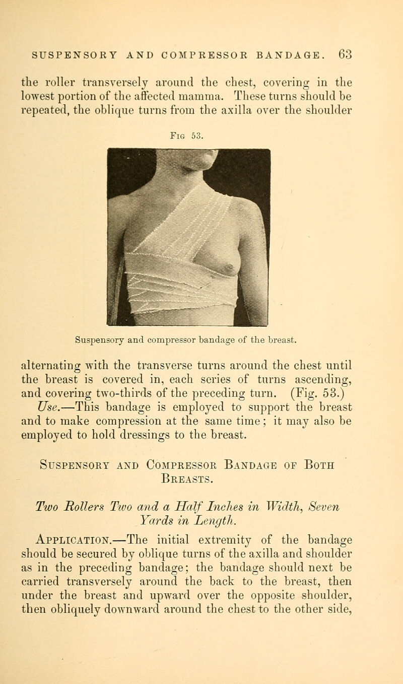 the roller transversely around the chest, covering in the lowest portion of the affected mamma. These turns should be repeated, the oblique turns from the axilla over the shoulder Fig 53. Suspensory and compressor bandage of the breast. alternating with the transverse turns around the chest until the breast is covered in, each series of turns ascending, and covering two-thirds of the preceding turn. (Fig. 53.) Use.—This bandage is employed to support the breast and to make compression at the same time; it may also be employed to hold dressings to the breast. Suspensory and Compressor Bandage of Both Breasts. Two Rollers Two and a Half Inches in Width, Seven Yards in Length. Application.—The initial extremity of the bandage should be secured by oblique turns of the axilla and shoulder as in the preceding bandage; the bandage should next be carried transversely around the back to the breast, then under the breast and upward over the opposite shoulder, then obliquely downward around the chest to the other side,