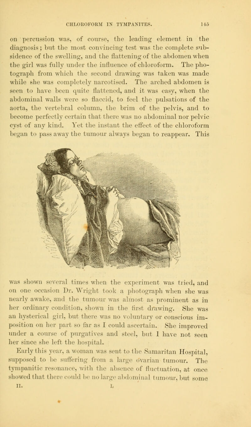 on percussion was, of course, the leading element in the diagnosis; but the most convincing test was the complete sub- sidence of the swelling, and the flattening of the abdomen when the girl was fully under the influence of chloroform. The pho- tograph from which the second drawing was taken was made while she was completely narcotised. The arched abdomen is seen to have been quite flattened, and it was easy, when the abdominal walls were so flaccid, to feel the pulsations of the aorta, the vertebral column, the brim of the pelvis, and to become perfectly certain that there was no abdominal nor pelvic cyst of any kind. Yet the instant the effect of the chloroform began to pass away the tumour always began to reappear. This was shown several times when the experiment was tried, and on one occasion Dr. Wright took a photograph when she was nearly awake, and the tumour was almost as prominent as in her ordinary condition, shown in the first drawing. She was an hysterical girl, but there was no voluntary or conscious im- position on her part so far as I could ascertain. She improved under a course of purgatives and steel, but 1 have not seen her since she left the hospital. Early this year, a woman was sent to the Samaritan Hospital, supposed to be suffering from a large ovarian tumour. The tympanitic resonance, with the absence of fluctuation, at once showed that there could be no large abdominal tumour, but some II. L