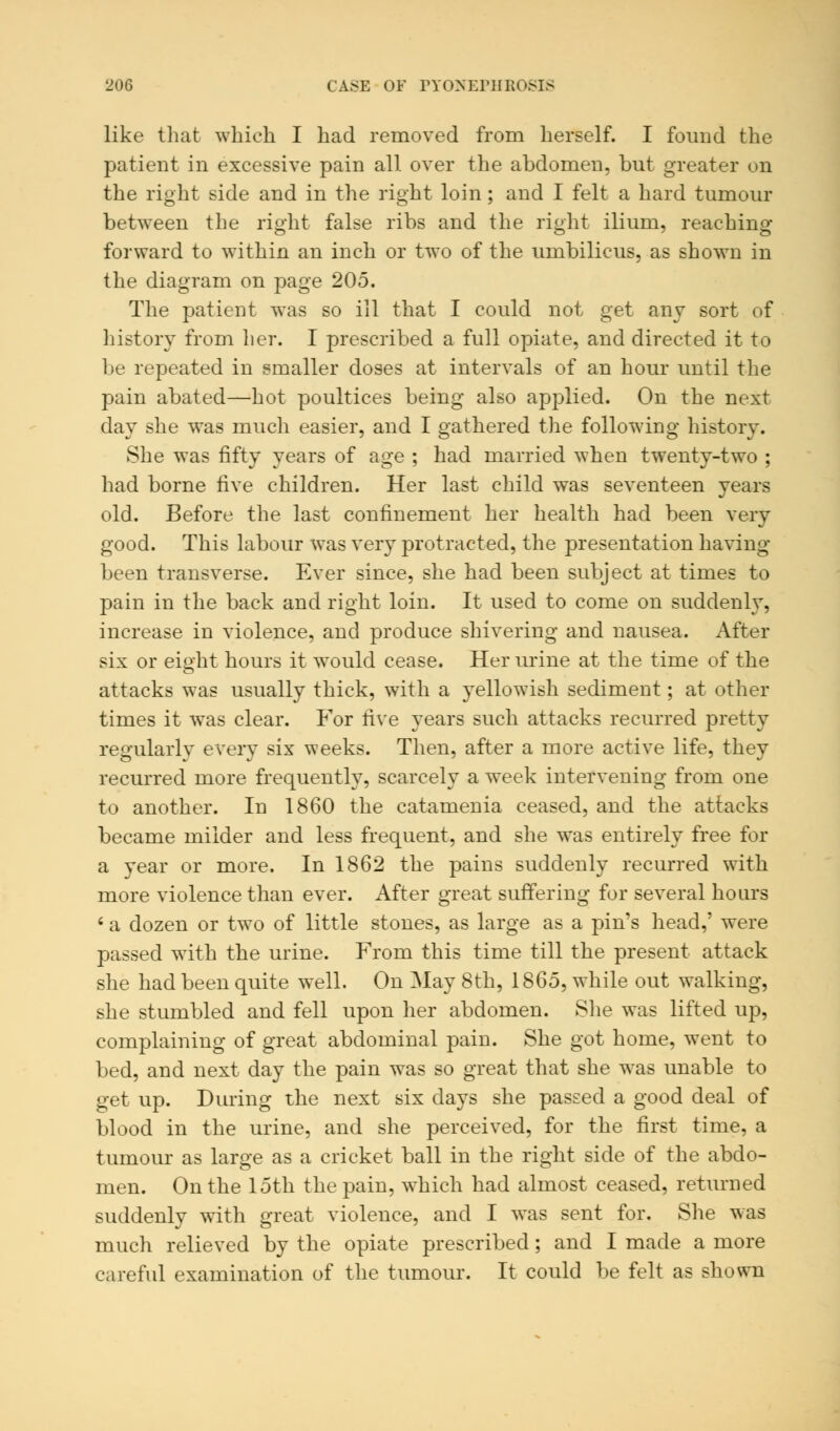 like that which I had removed from herself. I found the patient in excessive pain all over the abdomen, but greater on the right side and in the right loin; and I felt a hard tumour between the right false ribs and the right ilium, reaching forward to within an inch or two of the umbilicus, as shown in the diagram on page 205. The patient was so ill that I could not get any sort of history from her. I prescribed a full opiate, and directed it to be repeated in smaller doses at intervals of an hour until the pain abated—hot poultices being also applied. On the next day she was much easier, and I gathered the following history. She was fifty years of age ; had married when twenty-two ; had borne five children. Her last child was seventeen years old. Before the last confinement her health had been very good. This labour was very protracted, the presentation having been transverse. Ever since, she had been subject at times to pain in the back and right loin. It used to come on suddenly, increase in violence, and produce shivering and nausea. After six or eight hours it would cease. Her urine at the time of the attacks was usually thick, with a yellowish sediment; at other times it was clear. For five years such attacks recurred pretty regularly every six weeks. Then, after a more active life, they recurred more frequently, scarcely a week intervening from one to another. In 1860 the catamenia ceased, and the attacks became milder and less frequent, and she was entirely free for a year or more. In 1862 the pains suddenly recurred with more violence than ever. After great suffering for several hoars ' a dozen or two of little stones, as large as a pin's head,' were passed with the urine. From this time till the present attack she had been quite well. On May 8th, 1865, while out walking, she stumbled and fell upon her abdomen. She was lifted up, complaining of great abdominal pain. She got home, went to bed, and next day the pain was so great that she was unable to get up. During the next six days she passed a good deal of blood in the urine, and she perceived, for the first time, a tumour as large as a cricket ball in the right side of the abdo- men. On the 15th the pain, which had almost ceased, returned suddenly with great violence, and I was sent for. She was much relieved by the opiate prescribed; and I made a more careful examination of the tumour. It could be felt as shown