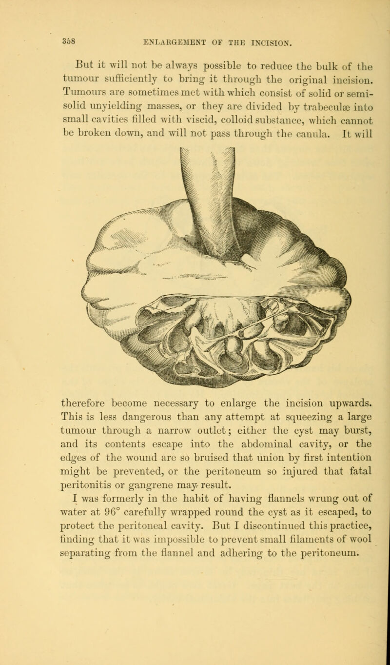 368 ENLARGEMENT OF THE INCISION. But it will not be always possible to reduce the bulk of the tumour sufficiently to bring it through the original incision. Tumours are sometimes met with which consist of solid or semi- solid unyielding masses, or they are divided by trabecule into small cavities filled with viscid, colloid substance, which cannot be broken down, and will not pass through the canula. It will therefore become necessary to enlarge the incision upwards. This is less dangerous than any attempt at squeezing a large tumour through a narrow outlet; either the cyst may burst, and its contents escape into the abdominal cavity, or the edges of the wound are so bruised that union by first intention might be prevented, or the peritoneum so injured that fatal peritonitis or gangrene may> result. I was formerly in the habit of having flannels wrung out of water at 96° carefully wrapped round the cyst as it escaped, to protect the peritoneal cavity. But I discontinued this practice, finding that it was impossible to prevent small filaments of wool separating from the flannel and adhering to the peritoneum.