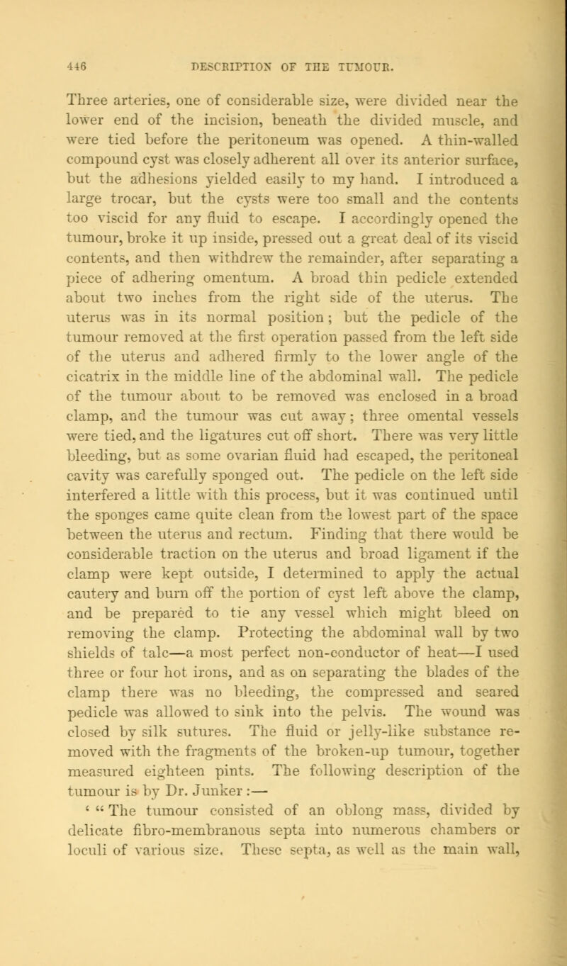 Three arteries, one of considerable size, were divided near the lower end of the incision, beneath the divided muscle, and were tied before the peritoneum was opened. A thin-walled compound cyst was closely adherent all over its anterior surface, but the adhesions yielded easily to my hand. I introduced a large trocar, but the cysts were too small and the contents too viscid for any fluid to escape. I accordingly opened the tumour, broke it up inside, pressed out a great deal of its viscid contents, and then withdrew the remainder, after separating a piece of adhering omentum. A broad thin pedicle extended about two inches from the right side of the uterus. The uterus was in its normal position; but the pedicle of the tumour removed at the first operation passed from the left side of the uterus and adhered firmly to the lower angle of the cicatrix in the middle line of the abdominal wall. The pedicle of the tumour about to be removed was enclosed in a broad clamp, and the tumour was cut away; three omental vessels were tied, and the ligatures cut off short. There was very little bleeding, but as some ovarian fluid had escaped, the peritoneal cavity was carefully sponged out. The pedicle on the left side interfered a little with this process, but it was continued until the sponges came quite clean from the lowest part of the space between the uterus and rectum. Finding that there would be considerable traction on the uterus and broad ligament if the clamp were kept outside, I determined to apply the actual cautery and burn off the portion of cyst left above the clamp, and be prepared to tie any vessel which might bleed on removing the clamp. Protecting the abdominal wall by two shields of talc—a most perfect non-conductor of heat—I used three or four hot irons, and as on separating the blades of the clamp there was no bleeding, the compressed and seared pedicle was allowed to sink into the pelvis. The wound was closed by silk sutures. The fluid or jelly-like substance re- moved with the fragments of the broken-up tumour, together measured eighteen pints. The following description of the tumour is by Dr. Junker :— ' M The tumour consisted of an oblong mass, divided by delicate nbro-membranous septa into numerous chambers or loculi of various *ize. These septa, as well as the main wall,