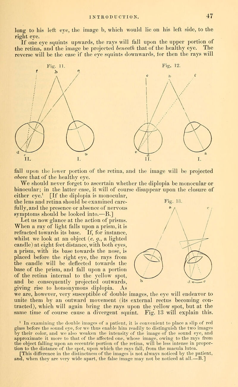long to his left eye, the image b, which would lie ou his left side, to the right eye. If one eye squints upwards, the rays will fall upon the upper portion of the retina, and the image be projected heneaih that of the healthy eye. The reverse will be the case if the eye squints downwards, for then the rays will Fie. 13. fall upon the lower portion of the retina, and the image will be projected above that of the healthy eye. We should never forget to ascertain whether the diplopia be monocular or binocular; in the latter case, it will of course disappear upon the closure of either eye.^ [If the diplopia is monocular, the lens and retina should be examined care- fully, and the presence or absence of nervous symptoms should be looked into.—B.] Let us now glance at the action of prisms. When a ray of light falls upon a prism, it is refracted towards its base. If, for instance, whilst we look at an object (e. g., a lighted candle) at eight feet distance, wdth both eyes, a prism, with its base towards the nose, is placed before the right eye, the rays from the candle will be deflected towards the base of the prism, and fall upon a portion of the retina internal to the yellow spot, and be consequently projected outwards, giving rise to homonymous diplopia. As we are, however, very susceptible of double images, the eye will endeavor to unite them by an outw'ard movement (its external rectus becoming con- tracted), which will again bring the rays upon the yellow spot, but at the same time of course cause a divergent squint. Fig. 13 will explain this. ^ In examining the double images of a patient, it is convenient to place a slip of red glass before the sound eye, for we thus enable him readily to distinguish the two images by their color, and we also weaken the intensity of the image of the sound eye, and approximate it more to that of the affected one, Avhose image, owing to the rays from the object falling upon an eccentric portion of the retina, will be less intense in propor- tion to the distance of the spot, upon which the rays fall, from the macula lutea. [This difference in the distinctness of the images is not always noticed by the patient, and, when they are very wide apart, the false image may not be noticed at all.—B.]