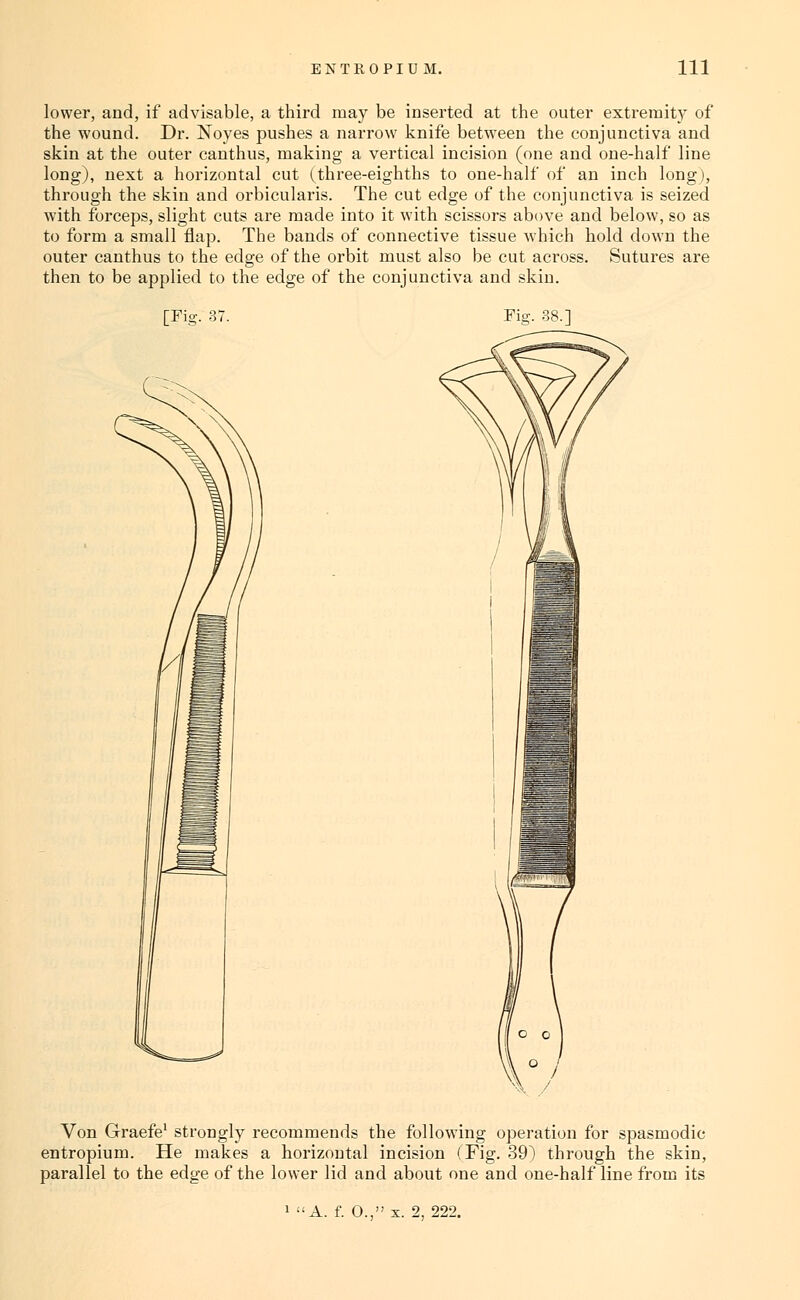 lower, and, if advisable, a third may be inserted at the outer extremit}' of the wound. Dr. Noyes pushes a narrow knife between the conjunctiva and skin at the outer canthus, making a vertical incision (one and one-half line long), next a horizontal cut (three-eighths to one-half of an inch long), through the skin and orbicularis. The cut edge of the conjunctiva is seized with forceps, slight cuts are made into it with scissors above and below, so as to form a small flap. The bands of connective tissue which hold down the outer canthus to the edge of the orbit must also be cut across. Sutures are then to be applied to the edge of the conjunctiva and skin. [Fig. 3v Fio-. Von Graefe' strongly recommends the following operation for spasmodic entropium. He makes a horizontal incision (Fig. 39) through the skin, parallel to the edge of the lower lid and about one and one-half line from its 1 A. f. 0., X. 2, 222.