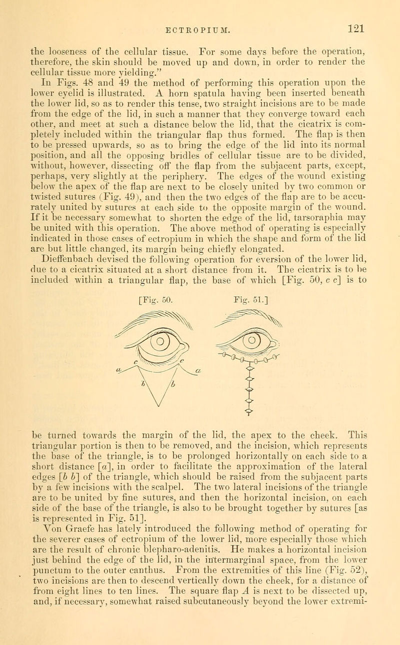 the looseness of the cellular tissue. For some days before the operation, therefore, the skin should be moved up and down, in order to render the cellular tissue more yielding. In Figs. 48 and 49 the method of performing this operation upon the lower eyelid is illustrated. A horn spatula having been inserted beneath the lower lid, so as to render this tense, two straight incisions are to be made from the edge of the lid, in such a manner that they converge toward each other, and meet at such a distance below the lid, that the cicatrix is com- pletely included within the triangular flap thus formed. The flap is then to be pressed upwards, so as to bring the edge of the lid into its normal position, and all the opposing bridles of cellular tissue are to be divided, Avithout, however, dissecting off the flap from the subjacent parts, except, perhaps, very slightly at the periphery. The edges of the wound existing below the apex of the flap are next to be closely united by two common or twisted sutures ^Fig. 49), and then the two edges of the flap are to be accu- rately united by sutures at each side to the opposite margin of the wound. If it be necessary somewhat to shorten the edge of the lid, tarsoraphia may be united with this operation. The above method of operating is especially indicated in those cases of ectropium in which the shape and form of the lid are but little changed, its margin being chiefly elongated. Dieffenbach devised the following operation for eversion of the low^er lid, due to a cicatrix situated at a short distance from it. The cicatrix is to be included within a triangular flap, the base of which [Fig. 50, c c] is to be turned towai'ds the margin of the lid, the apex to the cheek. This triangular portion is then to be removed, and the incision, which represents the base of the triangle, is to be prolonged horizontally on each side to a short distance [a], in order to facilitate the approximation of the lateral edges [b b'] of the triangle, which should be raised from the subjacent parts by a few incisions with the scalpel. The two lateral incisions of the triangle are to be united by fine sutures, and then the horizontal incision, on each side of the base of the triangle, is also to be brought together by sutures [as is represented in Fig. 51]. Von Graefe has lately introduced the following method of operating for the severer cases of ectropium of the lower lid, more especially those which are the result of chronic blepharo-adenitis. He makes a horizontal incision just behind the edge of the lid, in the intermarginal space, from the lower punctum to the outer canthus. From the extremities of this line (Fig. 52), two incisions are then to descend vertically down the cheek, for a distance of from eight lines to ten lines. The square flap A is next to be dissected up, and, if necessary, somewhat raised subcutaneously beyond the lower extremi-