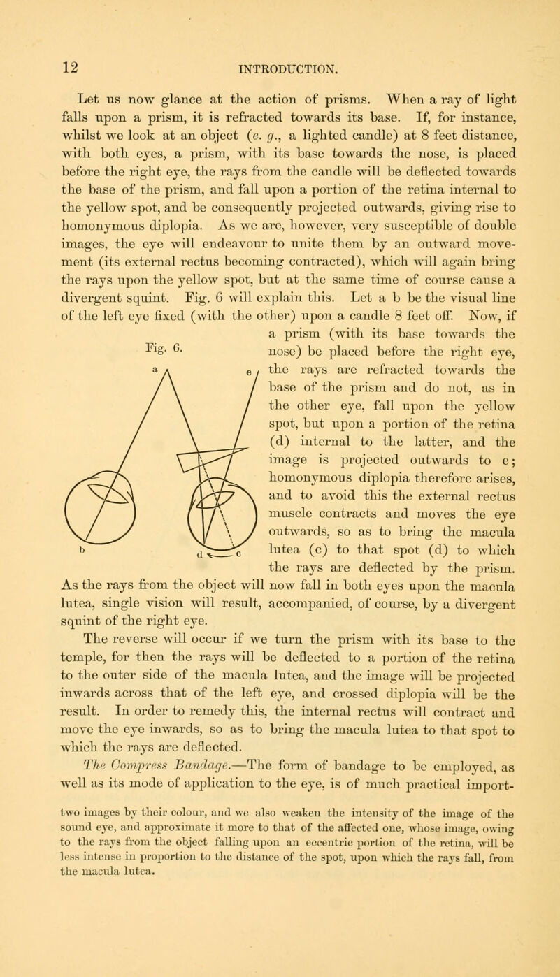 Let us now glance at the action of prisms. When a ray of light falls upon a prism, it is refracted towards its base. If, for instance, whilst we look at an object (e. g., a lighted candle) at 8 feet distance, with both eyes, a prism, with its base towards the nose, is placed before the right eye, the rays from the candle will be deflected towards the base of the prism, and fall upon a portion of the retina internal to the yellow spot, and be consequently projected outwards, giving rise to homonymous diplopia. As we are, however, very susceptible of double images, the eye will endeavour to unite them by an outward move- ment (its external rectus becoming contracted), which will again bring the rays upon the yellow spot, but at the same time of course cause a divergent squint. Fig, 6 will explain this. Let a b be the visual line of the left eye fixed (with the other) upon a candle 8 feet off. Now, if a prism (with its base towards the -^^S- ^- nose) be placed before the right eye, the rays are refracted towards the base of the prism and do not, as in the other eye, fall upon the yellow spot, but upon a portion of the retina (d) internal to the latter, and the image is projected outwards to e; homonymous diplopia therefore arises, and to avoid this the external rectus muscle contracts and moves the eye outwards, so as to bring the macula lutea (c) to that spot (d) to which the rays are deflected by the prism. As the rays fi^om the object will now fall in both eyes upon the macula lutea, single vision will result, accompanied, of course, by a divergent squint of the right eye. The reverse will occur if we turn the prism with its base to the temple, for then the rays will be deflected to a portion of the retina to the outer side of the macula lutea, and the image Avill be projected inwards across that of the left eye, and crossed diplopia will be the result. In order to remedy this, the internal rectus will contract and move the eye inwards, so as to bring the macula lutea to that spot to which the rays are deflected. The Compress Bandage.—The form of bandage to be employed, as well as its mode of application to the eye, is of much practical import- two images by their colour, and we also weaken the intensity of the image of the sound eye, and approximate it more to that of the affected one, whose image, owinj to the rays from the object falling npon an eccentric portion of the retina, will be less intense in proportion to the distance of the spot, upon which the rays fall, from the macula lutea.