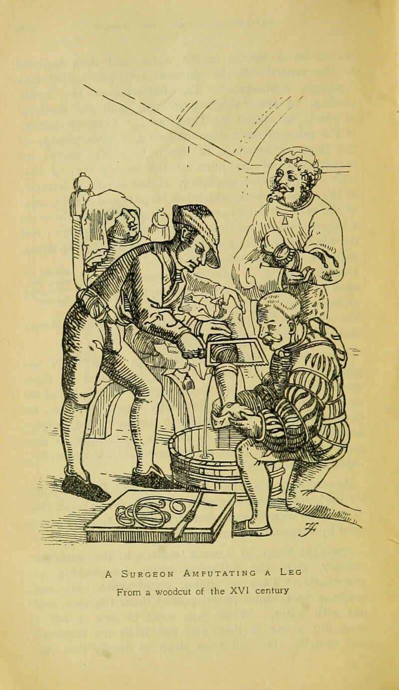A Surgeon Amputating a Leg