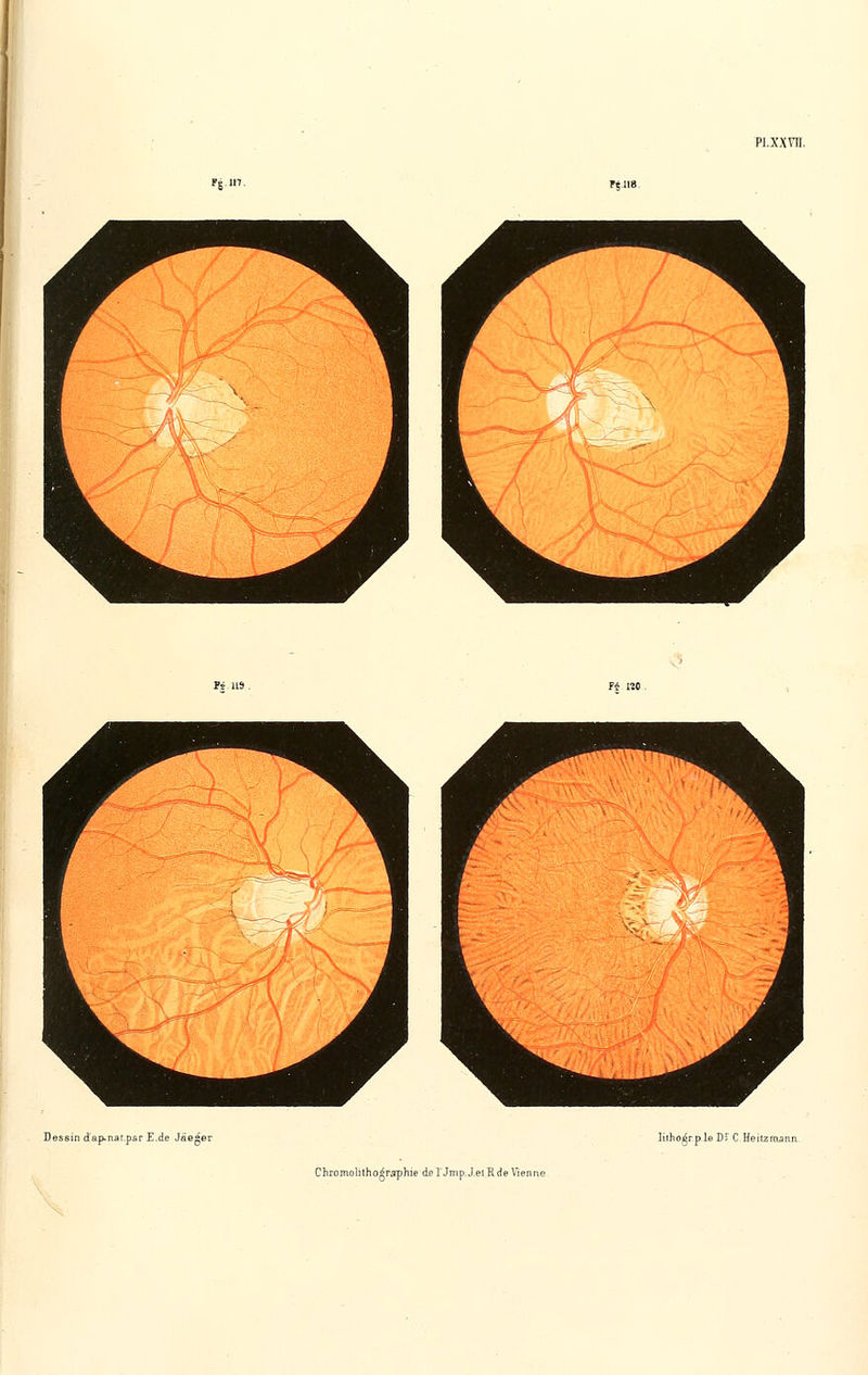 PI. XX vu Ftll8 Dessin d'ap-naipar E.de Jaeger liiho^rp le Dï C iïeitzmann.