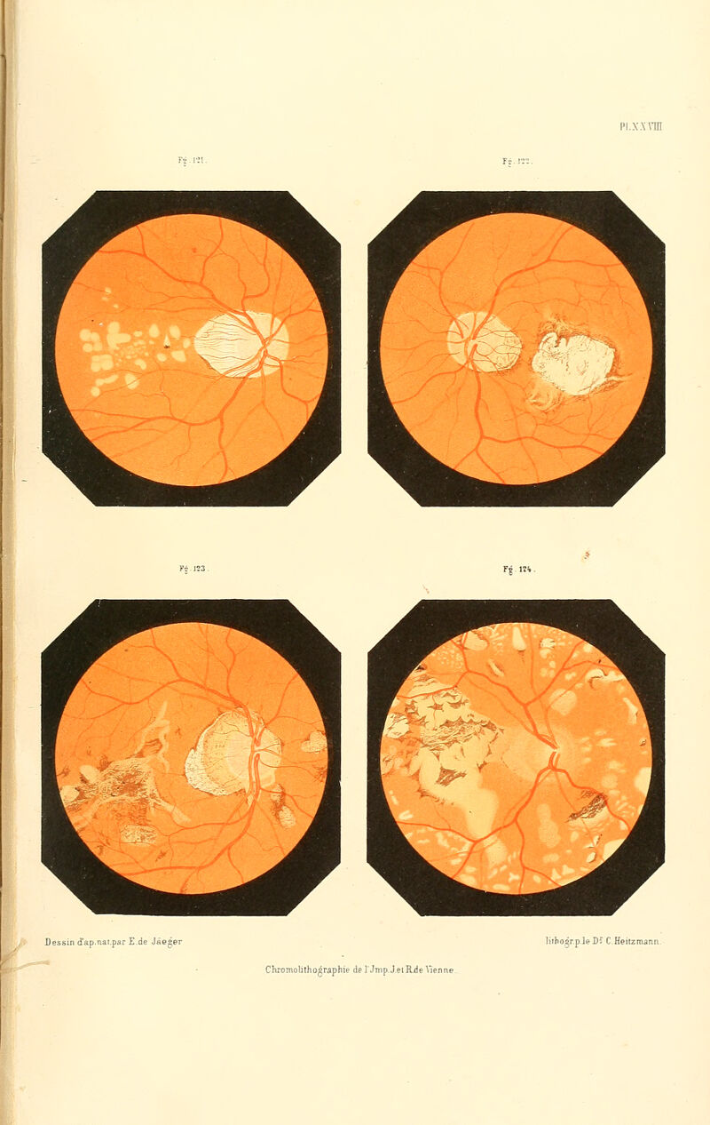 pi.x.xnn Fg 1?^- Dessin d'ap.nai.par E.de JaQger lithogr.p le D£ C Heiizmann