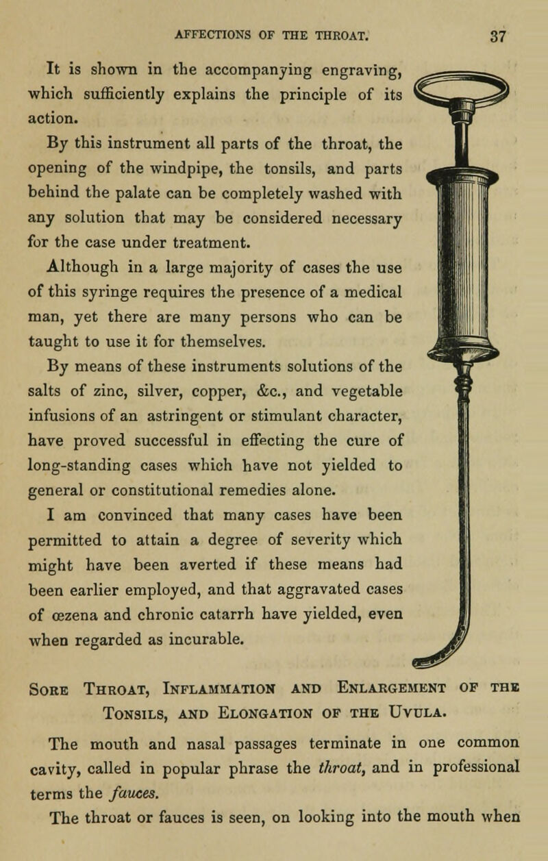 It is shown in the accompanying engraving, which sufficiently explains the principle of its action. By this instrument all parts of the throat, the opening of the windpipe, the tonsils, and parts behind the palate can be completely washed with any solution that may be considered necessary for the case under treatment. Although in a large majority of cases the use of this syringe requires the presence of a medical man, yet there are many persons who can be taught to use it for themselves. By means of these instruments solutions of the salts of zinc, silver, copper, &c, and vegetable infusions of an astringent or stimulant character, have proved successful in effecting the cure of long-standing cases which have not yielded to general or constitutional remedies alone. I am convinced that many cases have been permitted to attain a degree of severity which might have been averted if these means had been earlier employed, and that aggravated cases of cezena and chronic catarrh have yielded, even when regarded as incurable. Sore Throat, Inflammation and Enlargement of the Tonsils, and Elongation of the Uvula. The mouth and nasal passages terminate in one common cavity, called in popular phrase the throat, and in professional terms the fauces. The throat or fauces is seen, on looking into the mouth when