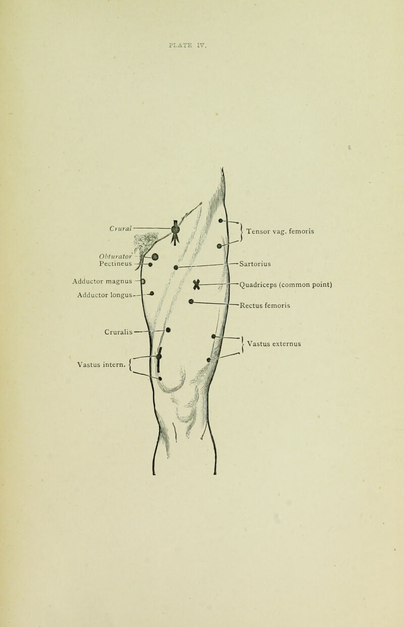 Cutral Adductor magnus Adductor longus j Ten sor vag. femoris Sartorius „ i X -7—iffl—Quadriceps (common point) —-Rectus femoris Vastus extemus