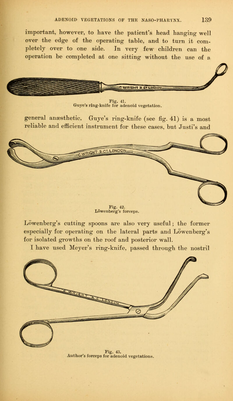 important, however, to have the patient's head hanging* well over the edge of the operating table, and to turn it com- pletely over to one side. In very few children can the operation be completed at one sitting without the use of a Fig. 41. Guye's ring-knife for adenoid vegetation. general anaesthetic. Guye's ring-knife (see fig. 41) is a most reliable and efficient instrument for these cases, but Justi's and Fig. 42. Lowenberg's forceps. Lowenberg's cutting spoons are also very useful; the former especially for operating on the lateral parts and Lowenberg's for isolated growths on the roof and posterior wall. I have used Meyer's ring-knife, passed through the nostril Fig. 43. Author's forceps for adenoid vegetations.