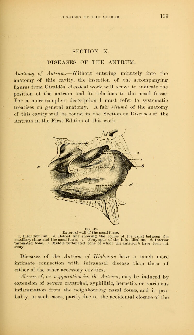 SECTION X. DISEASES OF THE ANTRUM. Anatomy of Antrum.—Without entering minutely into the anatomy of this cavity, the insertion of the accompanying- figures from Giraldes' classical work will serve to indicate the position of the antrum and its relations to the nasal fossae. For a more complete description I must refer to systematic treatises on general anatomy. A fair resume of the anatomy of this cavity will be found in the Section on Diseases of the Antrum in the First Edition of this work. Sl^^S^ '•'' ' • C\^ r~4 Fig. 49. External wall of the nasal fossae. a. Infundibulum. b. Dotted line showing the course of the canal between the maxillary sdnus and the nasal fossaj. c. Bony spur of the infundibulum. d. Inferior turbinated bone. e. Middle turbinated bone~ of which the anterior § have been cut away. Diseases of the Antrum of Highmore have a much more intimate connection with intranasal disease than those of cither of the other accessoiy cavities. Abscess of, or suppuration in, the Antrum, may he induced by extension of severe catarrhal, syphilitic, herpetic, or variolous inflammation from the neighbouring nasal fossae, and is pro- bably, in such cases, partly due to the accidental closure of the