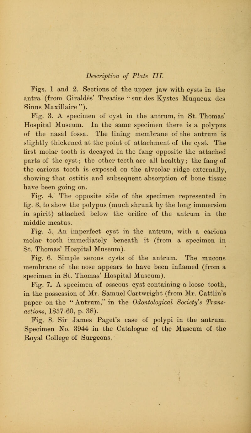 Figs. 1 and 2. Sections of the upper jaw with cysts in the antra (from Giraldes' Treatise  sur des Kystes Muqueux des Sinus Maxillaire ). Fig. 3. A specimen of cyst in the antrum, in St. Thomas' Hospital Museum. In the same specimen there is a polypus of the nasal fossa. The lining membrane of the antrum is slightly thickened at the point of attachment of the cyst. The first molar tooth is decayed in the fang opposite the attached parts of the cyst; the other teeth are all healthy; the fang of the carious tooth is exposed on the alveolar ridge externally, showing that ostitis and subsequent absorption of bone tissue have been going on. Fig. 4. The opposite side of the specimen represented in fig. 3, to show the polypus (much shrunk by the long immersion in spirit) attached below the orifice of the antrum in the middle meatus. Fig. 5. An imperfect cyst in the antrum, with a carious molar tooth immediately beneath it (from a specimen in St. Thomas' Hospital Museum). Fig. 6. Simple serous cysts of the antrum. The mucous membrane of the nose appears to have been inflamed (from a specimen in St. Thomas' Hospital Museum). Fig. 7. A specimen of osseous cyst containing a loose tooth, in the possession of Mr. Samuel Cartwright (from Mr. Cattlin's paper on the  Antrum, in the Odontological Society s Trans- actions, 1857-60, p. 38). Fig. 8. Sir James Paget's case of polypi in the antrum. Specimen No. 3944 in the Catalogue of the Museum of the Royal College of Surgeons.