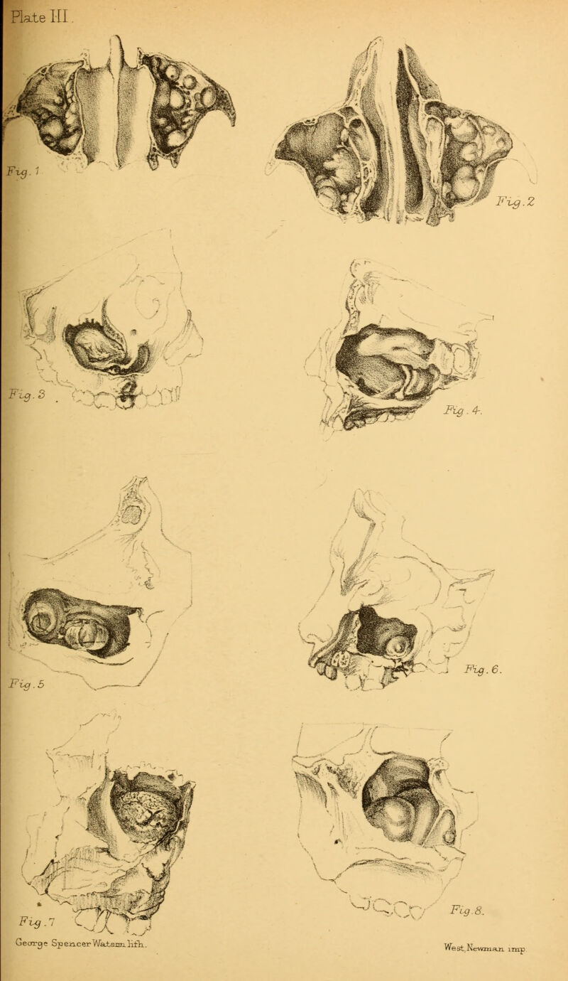 Plate III Fig.2 Fix*. 3 ' § Fig. 4-. Fig. 6. George Spea.cerWa.tsnn.loth..