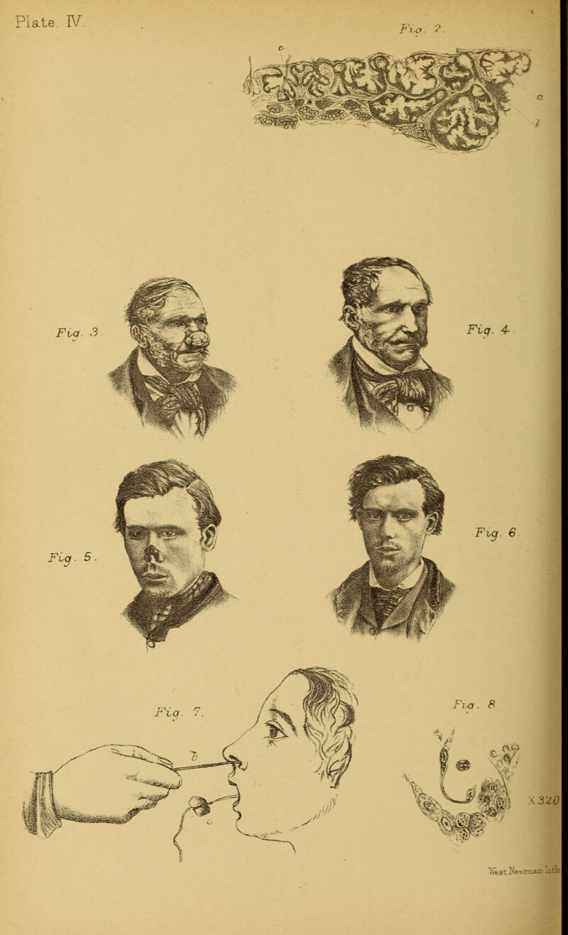 Plate. IV. Fig. 3 Fzq. 4 Fig. 6 Fia. 8 & %S^Jm X