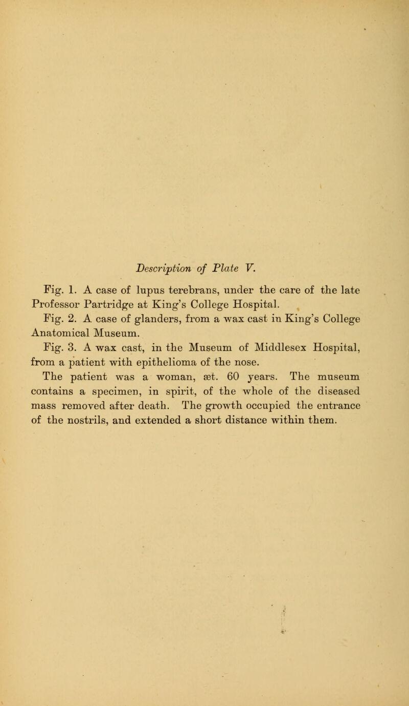 Fig. 1. A case of lupus terebrans, under the care of the late Professor Partridge at King's College Hospital. Fig. 2. A case of glanders, from a wax cast in King's College Anatomical Museum. Fig. 3. A wax cast, in the Museum of Middlesex Hospital, from a patient with epithelioma of the nose. The patient was a woman, set. 60 years. The museum contains a specimen, in spirit, of the whole of the diseased mass removed after death. The growth occupied the entrance of the nostrils, and extended a short distance within them.