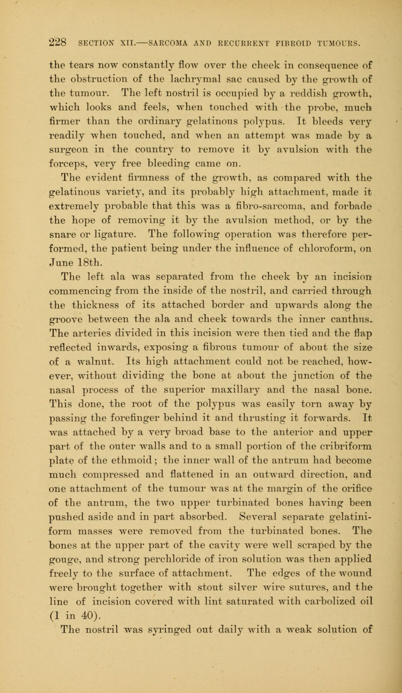 the tears now constantly flow over the cheek in consequence of the obstruction of the lachrymal sac caused by the growth of the tumour. The left nostril is occupied by a reddish growth, which looks and feels, when touched with the probe, much firmer than the ordinary gelatinous potypus. It bleeds very readily when touched, and when an attempt was made by a surgeon in the country to remove it by avulsion with the forceps, very free bleeding came on. The evident firmness of the growth, as compared with the gelatinous variety, and its probably high attachment, made it extremely probable that this was a fibro-sarcoma, and forbade the hope of removing it by the avulsion method, or by the snare or ligature. The following operation was therefore per- formed, the patient being under the influence of chloroform, on June 18th. The left ala was separated from the cheek by an incision commencing from the inside of the nostril, and carried through the thickness of its attached border and upwards along the groove between the ala and cheek towards the inner canthus. The arteries divided in this incision were then tied and the flap reflected inwards, exposing a fibrous tumour of about the size of a walnut. Its high attachment could not be reached, how- ever, without dividing the bone at about the junction of the nasal process of the superior maxillary and the nasal bone. This done, the root of the polypus was easily torn away by passing the forefinger behind it and thrusting it forwards. It was attached by a very broad base to the anterior and upper part of the outer walls and to a small portion of the cribriform plate of the ethmoid; the inner wall of the antrum had become much compressed and flattened in an outward direction, and one attachment of the tumour was at the margin of the orifice of the antrum, the two upper turbinated bones having been pushed aside and in part absorbed. Several separate gelatini- form masses were removed from the turbinated bones. The bones at the upper part of the cavity were well scraped by the gouge, and strong perchloride of iron solution was then applied freely to the surface of attachment. The edges of the wound were brought together with stout silver wire sutures, and the- line of incision covered with lint saturated with carbolized oil (1 in 40). The nostril was syringed out daily with a weak solution of