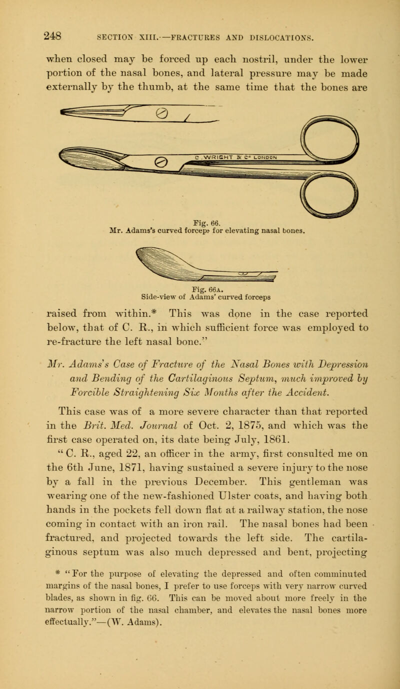 when closed may be forced up each, nostril, under the lower portion of the nasal bones, and lateral pressure may be made externally by the thumb, at the same time that the bones are Fig. 66. Mr. Adams's curved forceps for elevating nasal bones. Fig. 66a. Side-view of Adams' curved forceps raised from Avithin.* This was done in the case reported below, that of C. R., in which sufficient force was employed to re-fracture the left nasal bone. Mr. Adams's Case of Fracture of the Xasal Bones ivith Depression and Bending of the Cartilaginous Septum, much improved by Forcible Straightening Six Months after the Accident. This case was of a more severe character than that reported in the Brit. Med. Journal of Oct. 2, 1875, and which was the first case operated on, its date being July, 18(51.  C. R., aged 22. an officer in the army, first consulted me on the 6th June, 1871, having sustained a severe injury to the nose by a fall in the previous December. This gentleman was wearing one of the new-fashioned Ulster coats, and having both hands in the pockets fell down flat at a railway station, the nose coming in contact with an iron rail. The nasal bones had been fractured, and projected towards the left side. The cartila- ginous septum was also much depressed and bent, projecting *  For the purpose of elevating the depressed and often comminuted margins of the nasal bones, I prefer to use forceps with very narrow curved blades, as shown in fig. 66. This can be moved about more freely in the narrow portion of the nasal chamber, and elevates the nasal bones more effectually.—(W. Adams).