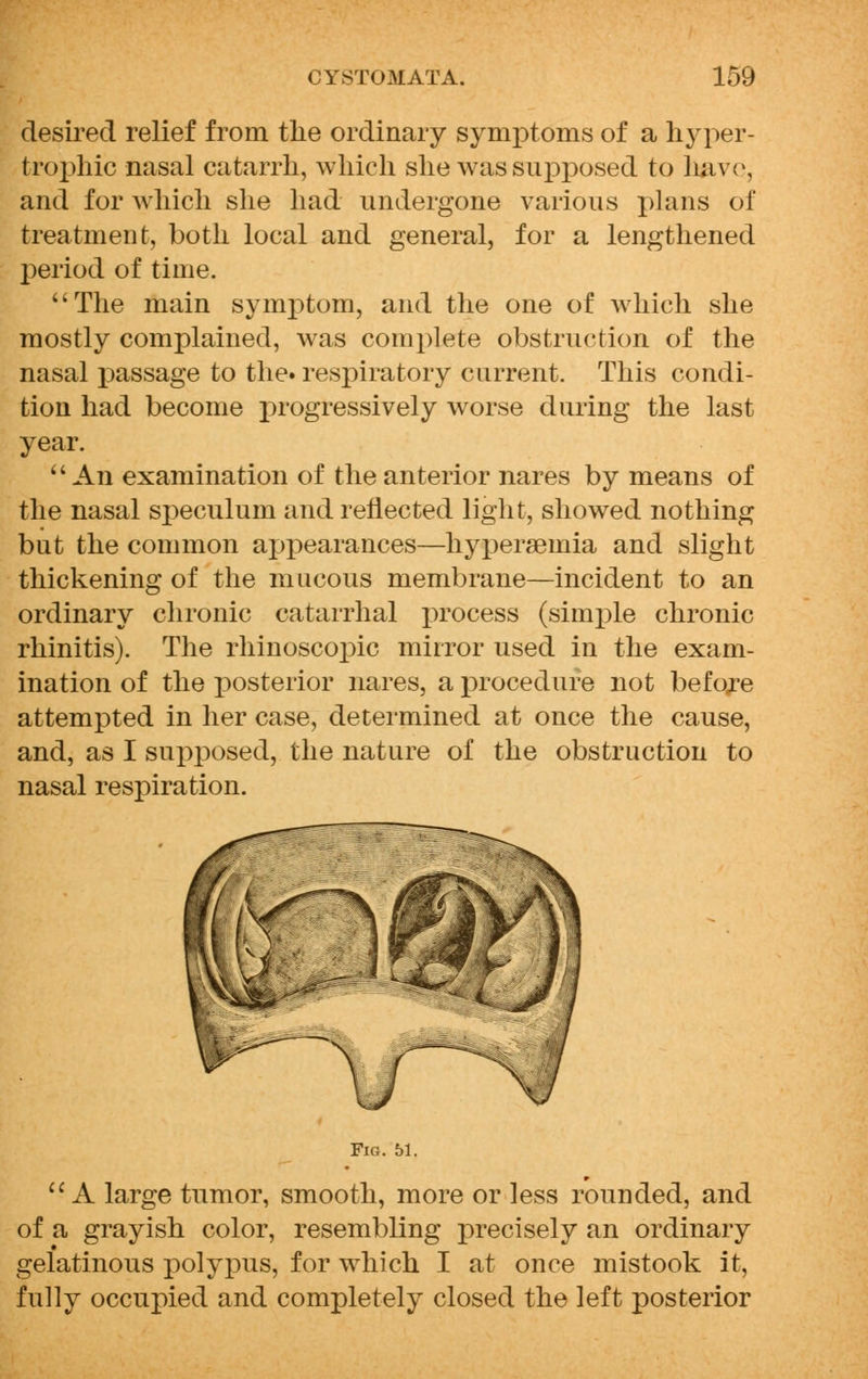 desired relief from the ordinary symptoms of a hyper- trophic nasal catarrh, which she was supposed to hav(\ and for which she had undergone various plans of treatment, both local and general, for a lengthened period of time. The main symptom, and the one of which she mostly complained, was complete obstruction of the nasal passage to the. respiratory current. This condi- tion had become progressively worse during the last year.  An examination of the anterior nares by means of the nasal speculum and reflected light, showed nothing but the common appearances—hyperseinia and slight thickening of the mucous membrane—incident to an ordinary chronic catarrhal x)rocess (simple chronic rhinitis). The rhinoscopic mirror used in the exam- ination of the posterior nares, a procedure not before attempted in her case, determined at once the cause, and, as I supposed, the nature of the obstruction to nasal respiration. Fig. 51. A large tumor, smooth, more or less rounded, and of a grayish color, resembling precisely an ordinary gelatinous polypus, for which I at once mistook it, fully occupied and completely closed the left posterior