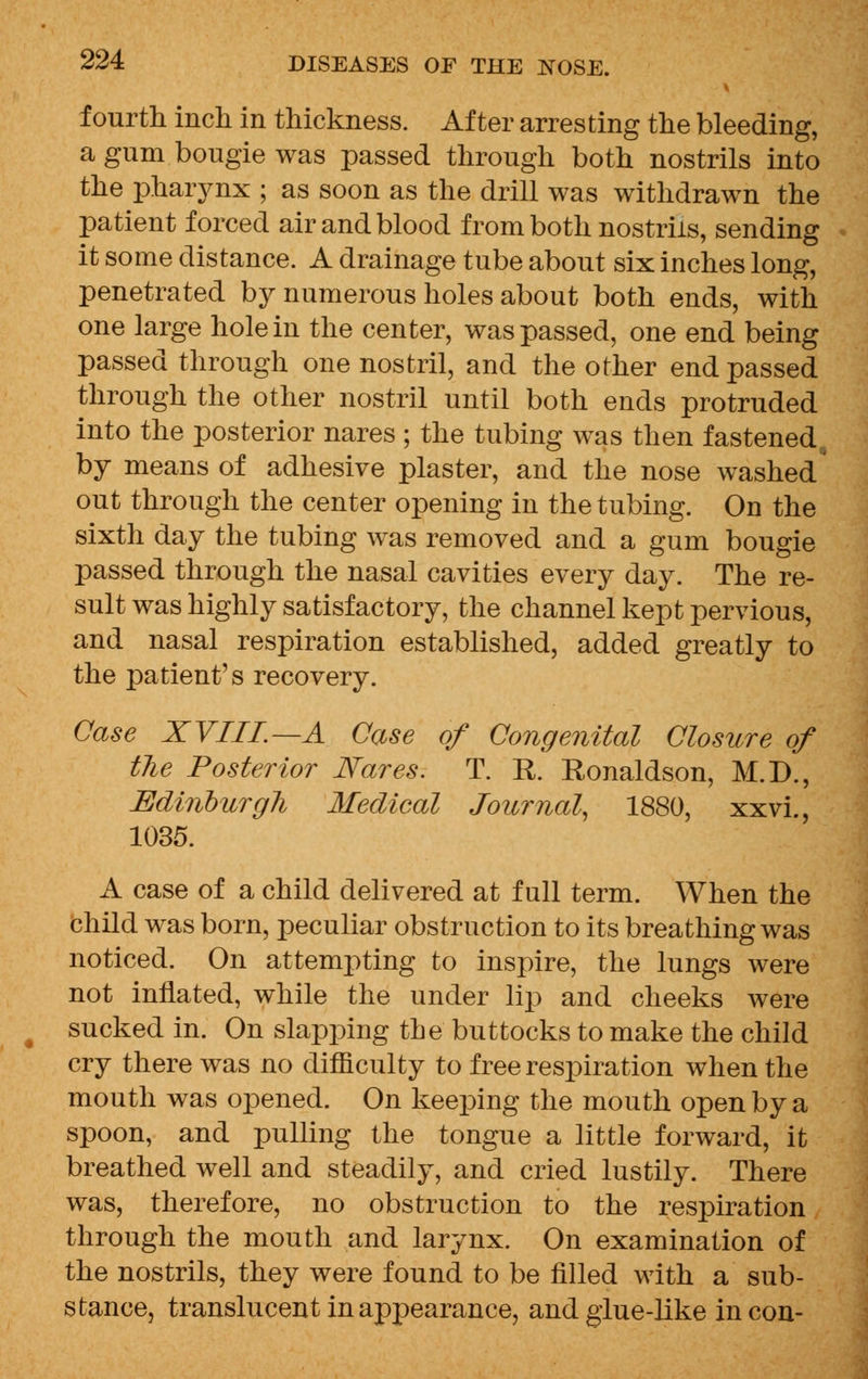 fourth inch in thickness. After arresting the bleeding, a gum bougie was passed through both nostrils into the pharynx ; as soon as the drill was withdrawn the patient forced air and blood from both nostrils, sending it some distance. A drainage tube about six inches long, penetrated by numerous holes about both ends, with one large hole in the center, was passed, one end being passed through one nostril, and the other end passed through the other nostril until both ends protruded into the posterior nares ; the tubing was then fastened^ by means of adhesive plaster, and the nose washed' out through the center opening in the tubing. On the sixth day the tubing was removed and a gum bougie passed through the nasal cavities every day. The re- sult was highly satisfactory, the channel kept pervious, and nasal respiration established, added greatly to the patient's recovery. Case XVIII.—A Case of Congenital Closure of the Posterior Nares. T. R. Ronaldson, M.D., Edinburgh Medical Journal, 1880, xxvi., 1035. A case of a child delivered at full term. When the child was born, peculiar obstruction to its breathing was noticed. On attempting to inspire, the lungs were not inflated, while the under lip and cheeks were sucked in. On slapping the buttocks to make the child cry there was no difficulty to free respiration when the mouth was opened. On keeping the mouth open by a spoon, and pulling the tongue a little forward, it breathed well and steadily, and cried lustily. There was, therefore, no obstruction to the respiration through the mouth and larynx. On examination of the nostrils, they were found to be filled with a sub- stance, translucent in appearance, and glue-like in con-