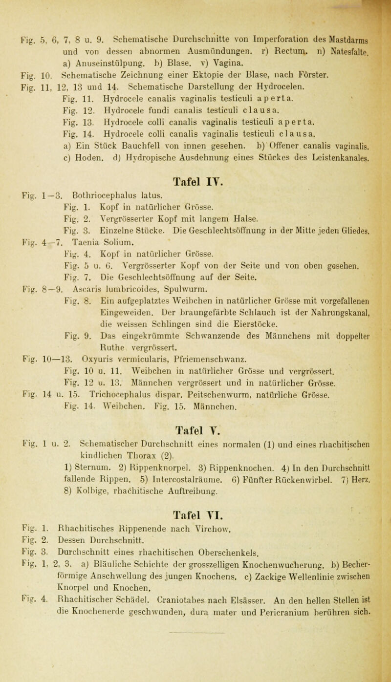 und von dessen abnormen Ausmündungen. r) Rectum, n) Katesfalte. a) Anuseinstülpung, b) Blase, v) Vagina. Fig. 10. Schematische Zeichnung einer Ektopie der Blase, nach Förster. Fig. 11, 12, 13 und 14. Schematische Darstellung der Hydrocelen. Fig. 11. Hydrocele canalis vaginalis testiculi aperta. Fig. 12. Hydrocele fundi canalis testiculi clausa. Fig. 13. Hydrocele colli canalis vaginalis testiculi aperta. Fig. 14. Hydrocele colli canalis vaginalis testiculi clausa. a) Ein Stück Bauchfell von innen gesehen, b) Offener canalis vaginalis. c) Hoden, d) Hydropische Ausdehnung eines Stückes des Leistenkanales. Tafel IT. Fig. 1—3. Bothriocephalus latus. Fig. 1. Kopf in natürlicher Grösse. Fig. 2. Vergrösserter Kopf mit langem Halse. Fig. 3. Einzelne Stücke. Die Geschlechtsöffnung in der Mitte jeden Gliedes. Fig. 4—7. Taenia Solium. Fig. 4. Kopf in natürlicher Grösse. Fig. 5 u. 6. Vergrösserter Kopf von der Seite und von oben gesehen. Fig. 7. Die Geschlechtsöffnung auf der Seite. Fig. 8—9. Ascaris lumbricoides, Spulwurm. Fig. 8. Ein aufgeplatztes Weibchen in natürlicher Grösse mit vorgefallenen Eingeweiden. Der braungefärbte Schlauch ist der Nahrungskanal, die weissen Schlingen sind die Eierstöcke. Fig. 9. Das eingekrümmte Schwanzende des Männchens mit doppelter Ruthe vergrössert. Fig. 10—13. Oxyuris vermicularis, Pfriemenschwanz. Fig. 10 u. 11. Weibchen in natürlicher Grösse und vergrössert. Fig. 12 u. 13, Männchen vergrössert und in natürlicher Grösse. Fig. 14 u. 15. Trichocephalus dispar. Peitschenwurm, natürliche Grösse. Fig. 14. Weibchen. Fig. 15. Männchen. Tafel T. Fig. 1 u. 2. Schematischer Durchschnitt eines normalen (1) und eines rbachitischen kindlichen Thorax (2). 1) Sternum. 2) Rippenknorpel. 3) Rippenknochen. 4) In den Durchschnitt fallende Rippen. 5) Intercostalräume. 6) Fünfter Rückenwirbel. 7) Herz. 8) Kolbige, rhachitische Auftreibung. Tafel Tl. Fig. 1. Rhachitisehes Rippenende nach Virchow. Fig. 2. Dessen Durchschnitt. Fig. 3. Durchschnitt eines rbachitischen Oberschenkels. Fig. 1, 2, 3. a) Bläuliche Schichte der grosszelligen Knochenwucherung, b) Becher- förmige Anschwellung des jungen Knochens, c) Zackige Wellenlinie zwischen Knorpel und Knochen. Fig. 4. Rhachitischer Schädel. Graniotabes nach Elsässer. An den hellen Stellen ist die Knocheneide geschwunden, dura mater und Pericranium berühren sich.
