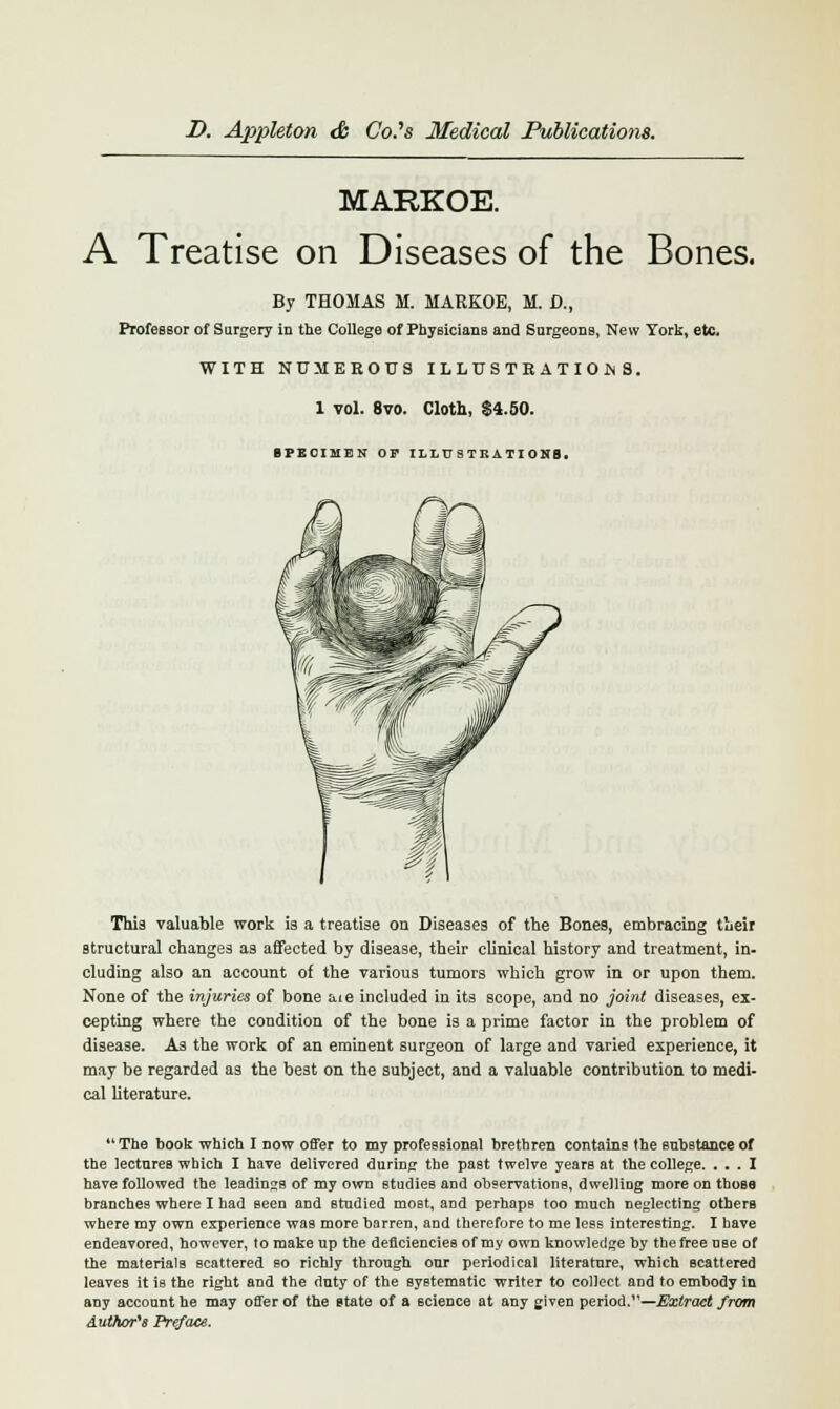 MARKOE. A Treatise on Diseases of the Bones. By THOMAS M. MARKOE, M. D., Professor of Surgery in the College of Physicians and Snrgeons, New York, etc. WITH NUMEROUS ILL1ISTEATIOM8. 1 vol. 8vo. Cloth, $4.50. SPECIMEN' OP ILLUSTRATIONS. This valuable work is a treatise on Diseases of the Bones, embracing their structural changes as affected by disease, their clinical history and treatment, in- cluding also an account of the various tumors which grow in or upon them. None of the injuries of bone a.ie included in its scope, and no joint diseases, ex- cepting where the condition of the bone is a prime factor in the problem of disease. As the work of an eminent surgeon of large and varied experience, it may be regarded as the best on the subject, and a valuable contribution to medi- cal literature.  The book which I now offer to my professional brethren contains the substance of the lectures which I have delivered during the past twelve years at the college. ... I have followed the leadings of my own studies and observations, dwelling more on those branches where I had seen and studied most, and perhaps too much neglecting others where my own experience was more barren, and therefore to me less interesting. I have endeavored, however, to make up the deficiencies of my own knowledge by the free use of the materials scattered so richly through our periodical literature, which scattered leaves it is the right and the duty of the systematic writer to collect and to embody in any account he may offer of the state of a science at any given period.1'—Extract from Author's Preface.