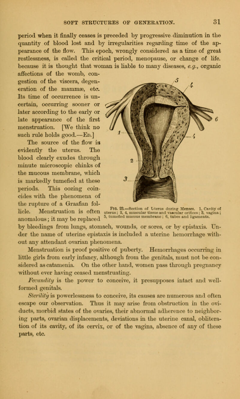period when it finally ceases is preceded by progressive diminution in the quantity of blood lost and by irregularities regarding time of the ap- pearance of the flow. This epoch, wrongly considered as a time of great restlessness, is called the critical period, menopause, or change of life, because it is thought that woman is liable to many diseases, e.g., organic affections of the womb, con- gestion of the viscera, degen- eration of the mammse, etc. Its time of occurrence is un- certain, occurring sooner or later according to the early or late appearance of the first menstruation. [We think no such rule holds good.—Ed.] The source of the flow is evidently the uterus. The blood clearly exudes through minute microscopic chinks of the mucous membrane, which is markedly tumefied at these periods. This oozing coin- cides with the phenomena of the rupture of a Graafian fol- v , ,r , ,. . p, FIG. 23.—Section of Lterus during Men???. 1. Cavity of UCle. Menstruation IS Otteil uterus: t, ■». muscular tissue and vascular orifloes; 3. vagina; i •, i i i 5, tumefied mucous membrane; (i, tubes and ligaments. anomalous; it may be replaced b by bleedings from lungs, stomach, wounds, or sores, or by epistaxis. Un- der the name of uterine epistaxis is included a uterine hemorrhage with- out any attendant ovarian phenomena. Menstruation is proof positive of puberty. Hemorrhages occurring in little girls from early infancy, although from the genitals, must not be con- sidered as catamenia. On the other hand, women pass through pregnancy without ever having ceased menstruating. Fecundity is the power to conceive, it presupposes intact and well- formed genitals. Sterility is powerlessnees to conceive, its causes arc numerous and often escape our observation. Thus it may arise from obstruction in the ovi- ducts, morbid states of the ovaries, their abnormal adherence to neighbor- ing parts, ovarian displacements, deviations in the uterine canal, oblitera- tion of its cavity, of its cervix, or of the vagina, absence of any of these parts, etc.