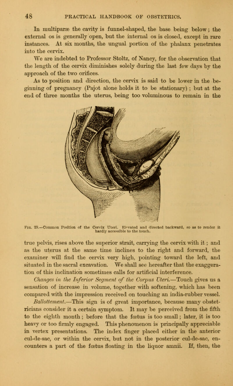 In multipara the cavity is funnel-shaped, the base being below; the external os is generally open, but the internal os is closed, except in rare instances. At six months, the ungual portion of the phalanx penetrates into the cervix. We are indebted to Professor Stoltz, of Nancy, for the observation that the length of the cervix diminishes solely during the last few days by the approach of the two orifices. As to position and direction, the cervix is said to be lower in the be- ginning of pregnancy (Pajot alone holds it to be stationary) ; but at the end of three months the uterus, being too voluminous to remain in the Fig. 29.—Common Position of the Cervix Uteri. El°vated and directed backward, so aB to render it hardly accessible to the touch. true pelvis, rises above the superior strait, carrying the cervix with it; and as the uterus at the same time inclines to the right and forward, the examiner will find the cervix very high, pointing toward the left, and situated in the sacral excavation. We shall see hereafter that the exaggera- tion of this inclination sometimes calls for artificial interference. Changes in the Inferior Segment of the Corpus Uteri.—Touch gives us a sensation of increase in volume, together with softening, which has been compared with the impression received on touching an india-rubber vessel. Ballottement.—This sign is of great importance, because many obstet- ricians consider it a certain symptom. It may be perceived from the fifth to the eighth month ; before that the foetus is too small; later, it is too heavy or too firmly engaged. This phenomenon is principally appreciable in vertex presentations. The index finger placed either in the anterior cul-de-sac, or within the cervix, but not in the posterior cul-de-sac, en- counters a part of the foetus floating in the liquor amnii. If, then, the