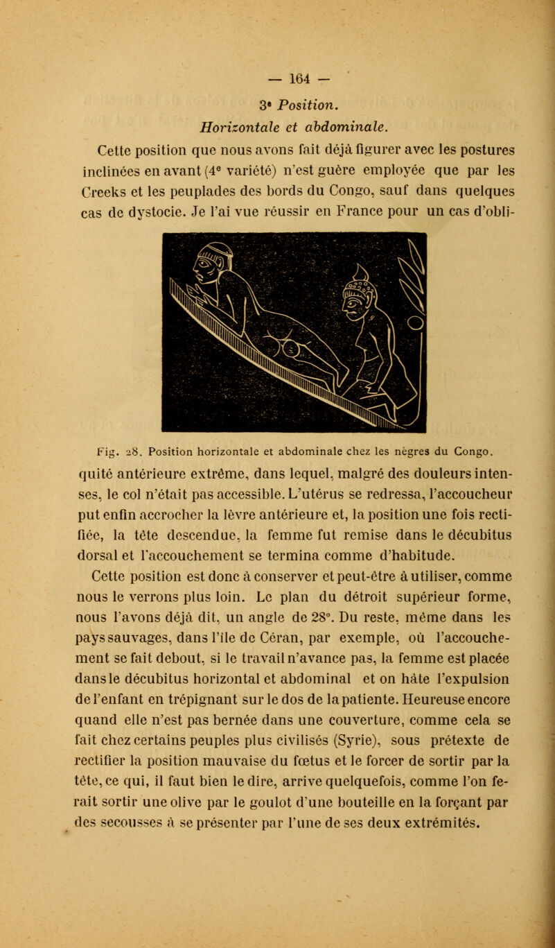 3e Position, Horizontale et abdominale. Cette position que nous avons fait déjà figurer avec les postures inclinées en avant (4e variété) n'est guère employée que par les Creeks et les peuplades des bords du Congo, sauf dans quelques cas de dvstocie. Je l'ai vue réussir en France pour un cas d'obli- Fig. 28. Position horizontale et abdominale chez les nègres du Congo. quité antérieure extrême, dans lequel, malgré des douleurs inten- ses, le col n'était pas accessible. L'utérus se redressa, l'accoucheur put enfin accrocher la lèvre antérieure et, la position une fois recti- fiée, la tête descendue, la femme fut remise dans le décubitus dorsal et l'accouchement se termina comme d'habitude. Cette position est donc à conserver et peut-être à utiliser, comme nous le verrons plus loin. Le plan du détroit supérieur forme, nous l'avons déjà dit, un angle de 28°. Du reste, même dans les pays sauvages, dans l'île de Céran, par exemple, où l'accouche- ment se fait debout, si le travail n'avance pas, la femme est placée dans le décubitus horizontal et abdominal et on hâte l'expulsion de l'enfant en trépignant sur le dos de la patiente. Heureuse encore quand elle n'est pas bernée dans une couverture, comme cela se fait chez certains peuples plus civilisés (Syrie), sous prétexte de rectifier la position mauvaise du fœtus et le forcer de sortir par la tête, ce qui, il faut bien le dire, arrive quelquefois, comme l'on fe- rait sortir une olive par le goulot d'une bouteille en la forçant par des secousses à se présenter par l'une de ses deux extrémités.