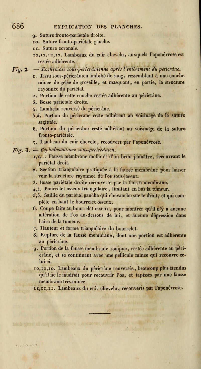 9. Suture fronto-pariétale droite. 10. Suture fronto-pariétale gauche. 11. Suture coronale. 12,12,12,12. Lambeaux du cuir chevelu, auxquels l'aponévrose est restée adhérente. Fig. 2. — Ecchymose s ou s-p crier antenne après l'enlèvement Ru péricrâne. t. Tissu sous-péricrânien imbibé de sang, ressemblant à une couche mince de gelée de groseille, et masquant, en partie, la structure rayonnée du pariétal. 2. Portion de cette couche restée adhérente au péricrâne* 3. Bosse pariétale droite. 4. Lambeau renversé du péricrâne. 5,5. Portion du péricrâne resté adhérent au voisinage de la suture sagittale. 6. Portion du péricrâne resté adhérent au voisinage de la suture fronto-pariétale. 7. Lambeau du cuir chevelu, recouvert par l'aponévrose. Fig* 3. — Céphalœmatome sous-péricrânien. i,r,i. Fausse membrane molle et d'un brun jaunâtre, recouvrant le pariétal droit. 2. Section triangulaire pratiquée à la fausse membrane pour laisser voir la structure rayonnée de l'os sous-jacent. 3. Bosse pariétale droite recouverte par la fausse membrane. 4.4. Bourrelet osseux triangulaire, limitant en bas la tumeur. 5.5. Saillie du pariétal gauche qui chevauche sur le droit, et qui com- plète en haut le bourrelet osseux. 6. Coupe faite au bourrelet osseux, pour montrer qu'il n'y a aucune altération de l'os au-dessous de lui, et aucune dépression dans l'aire de la tumeur. 7. Hauteur et forme triangulaire du bourrelet. 8. Rupture de la fausse membrane, dont une portion est adhérente au péricrâne. 9. Portion de la fausse membrane rompue, restée adhérente au péri- crâne, et se continuant avec une pellicule mince qui recouvre ce- lui-ci. 10,10,10. Lambeaux du péricrâne renversés, beaucoup plus étendus qu'il ne le faudrait pour recouvrir l'os, et tapissés par une fausse membrane très-mince. iï,n,ii. Lambeaux du cuir chevelu, recouverts par l'aponévrose.