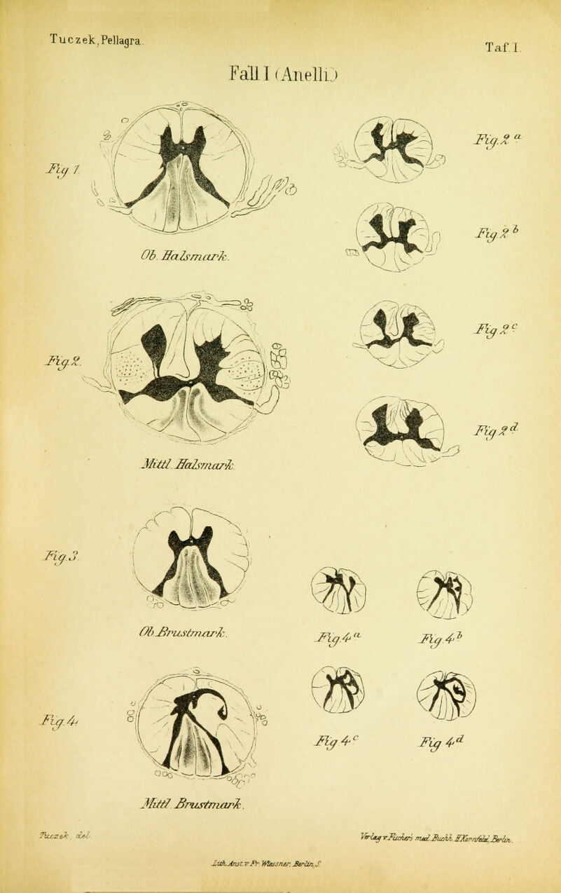 Taf.I. Fall 1( Anellt» Tu/ / Ob ffalsmurk Fig.Z Jfy*> Müti ficrfsmark P«l^ M?J><- Fig. 2 d. FZg.i Füj.& Ob Jlrust/n/wk j. IR/tf ßrustmark. Fig.4CL c \r.'l\, Mg4-L Fuji* Fig4d Tu.cz t' VtrUfyFuAiri mxlZuM. BCmtedBrlui luKjtnst vjy Wtessntr. ArfoiS