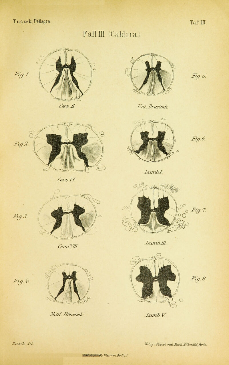 Fall IE (Caldara.) % / Cerv.H. Vrit Ifritstjnk. FyS ''// /'U/.l 'Fig.4*. Cerv TT CerolTÜ Mttl. BntsimA- LxuribJ Fig.6. <13 Lumi V TuczJ: iel Verlan tFlxÄws WAjU FXernfetd I&Ivl K&SS/1&] JSerän-. S
