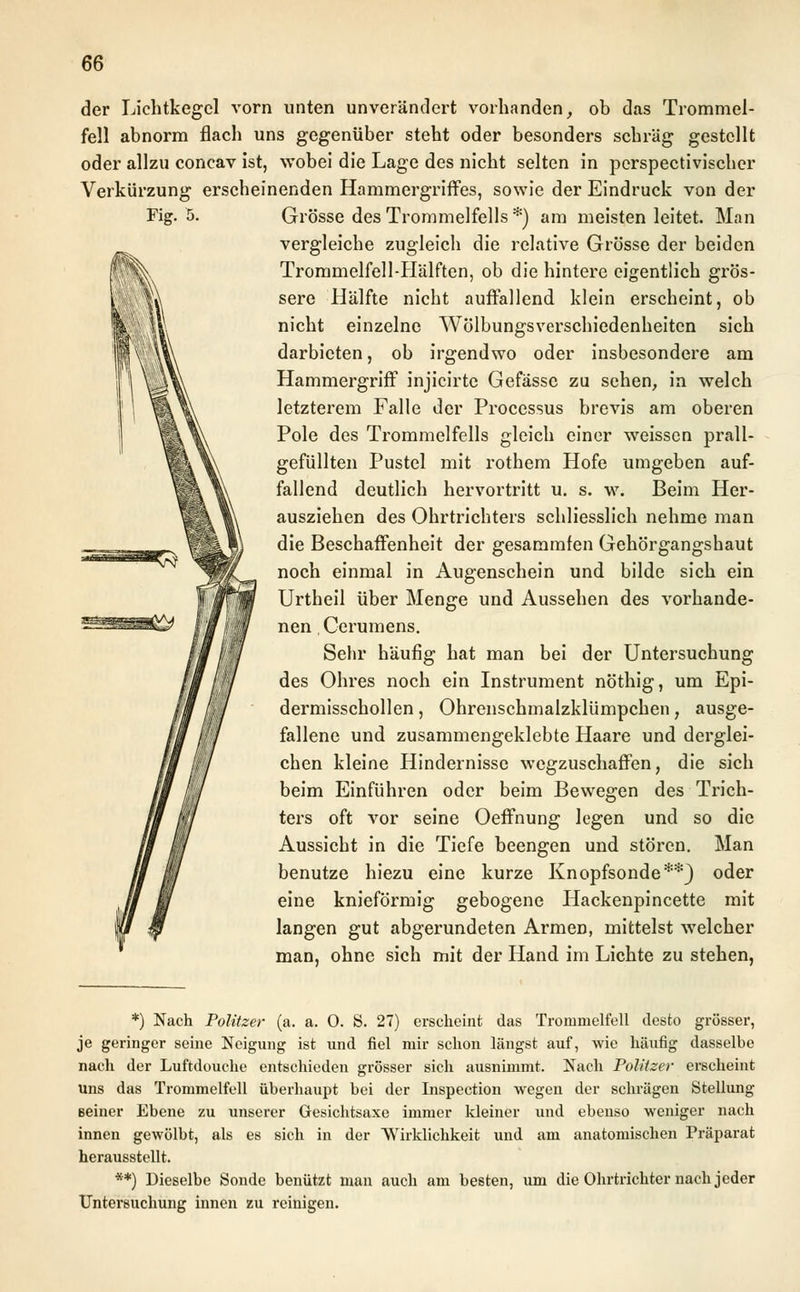 der Lichtkegel vorn unten unverändert vorhanden, ob das Trommel- fell abnorm flach uns gegenüber steht oder besonders schräg gestellt oder allzu concav ist, wobei die Lage des nicht selten in perspectivischer Verkürzung erscheinenden Hammergriffes, sowie der Eindruck von der Fig. 5. Grösse des Trommelfells *) am meisten leitet. Man vergleiche zugleich die relative Grösse der beiden Trommelfell-Hälften, ob die hintere eigentlich grös- sere Hälfte nicht auffallend klein erscheint, ob nicht einzelne Wölbungsverschiedenheiten sich darbieten, ob irgendwo oder insbesondere am Hammergriff injicirte Gefasse zu sehen, in welch letzterem Falle der Processus brevis am oberen Pole des Trommelfells gleich einer weissen prall- gefüllten Pustel mit rothem Hofe umgeben auf- fallend deutlich hervortritt u. s. w. Beim Her- ausziehen des Ohrtrichters schliesslich nehme man die Beschaffenheit der gesammfen Gehörgangshaut noch einmal in Augenschein und bilde sich ein Urtheil über Menge und Aussehen des vorhande- nen Cerumens. Sehr häufig hat man bei der Untersuchung des Ohres noch ein Instrument nöthig, um Epi- dermisschollen , Ohrenschmalzklümpchen, ausge- fallene und zusammengeklebte Haare und derglei- chen kleine Hindernisse wegzuschaffen, die sich beim Einführen oder beim Bewegen des Trich- ters oft vor seine Oeffnung legen und so die Aussicht in die Tiefe beengen und stören. Man benutze hiezu eine kurze Knopfsonde**) oder eine knieförmig gebogene Hackenpincette mit langen gut abgerundeten Armen, mittelst welcher man, ohne sich mit der Hand im Lichte zu stehen, *) Nach Politzer (a. a. 0. S. 27) erscheint das Trommelfell desto grösser, je geringer seine Neigung ist und fiel mir schon längst auf, wie häufig dasselbe nach der Luftdouche entschieden grösser sich ausnimmt. Nach Politzer erscheint Uns das Trommelfell überhaupt bei der Inspection wegen der schrägen Stellung Beiner Ebene zu unserer Gesichtsaxe immer kleiner und ebenso weniger nach innen gewölbt, als es sich in der Wirklichkeit und am anatomischen Präparat herausstellt. **) Dieselbe Sonde benützt man auch am besten, um die Ohrtrichter nach jeder Untersuchung innen zu reinigen.