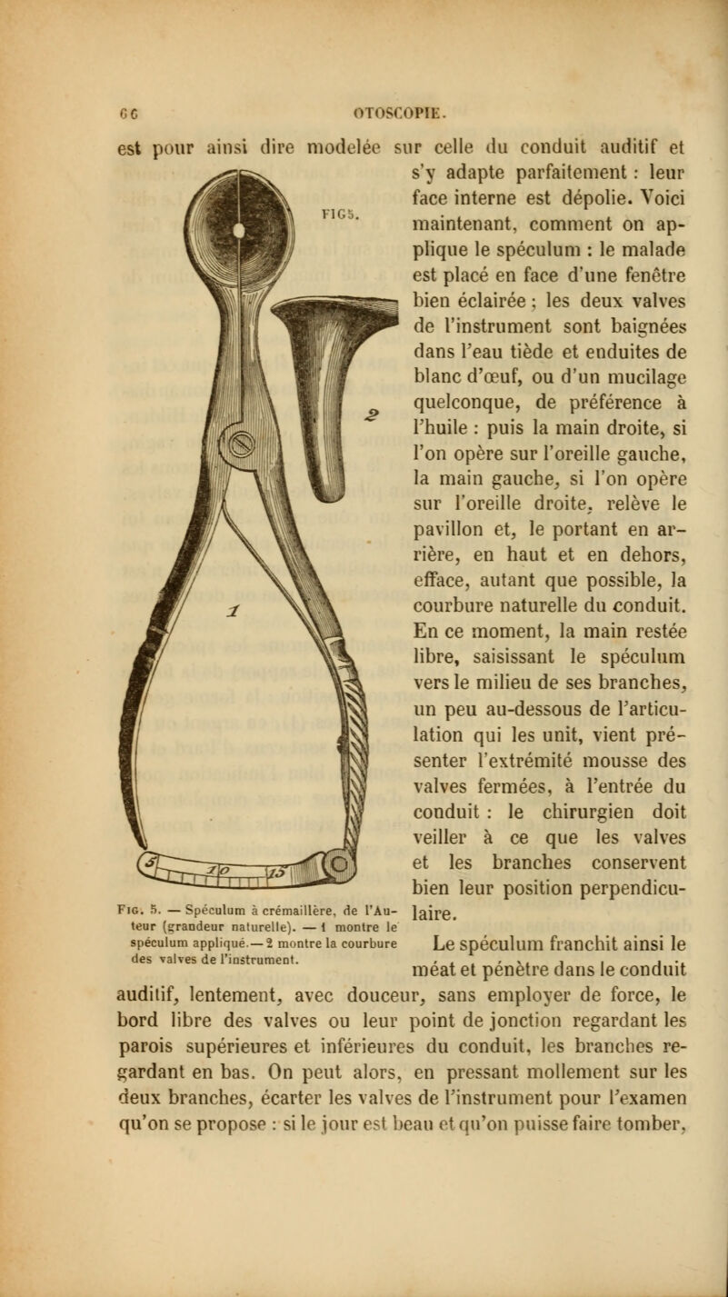 F1GS. est pour ainsi dire modelée sur celle du conduit auditif et s'y adapte parfaitement : leur face interne est dépolie. Voici maintenant, comment on ap- plique le spéculum : le malade est placé en face d'une fenêtre bien éclairée : les deux valves de l'instrument sont baignées dans l'eau tiède et enduites de blanc d'oeuf, ou d'un mucilage quelconque, de préférence à l'huile : puis la main droite, si l'on opère sur l'oreille gauche, la main gauche, si l'on opère sur l'oreille droite, relève le pavillon et, le portant en ar- rière, en haut et en dehors, efface, autant que possible, la courbure naturelle du conduit. En ce moment, la main restée libre, saisissant le spéculum vers le milieu de ses branches, un peu au-dessous de l'articu- lation qui les unit, vient pré- senter l'extrémité mousse des valves fermées, à l'entrée du conduit : le chirurgien doit veiller à ce que les valves (ff^Z^Jio tâT^IpI et ^es branches conservent bien leur position perpendicu- laire. Le spéculum franchit ainsi le méat et pénètre dans le conduit auditif, lentement, avec douceur, sans employer de force, le bord libre des valves ou leur point de jonction regardant les parois supérieures et inférieures du conduit, les branches re- gardant en bas. On peut alors, en pressant mollement sur les deux branches, écarter les valves de l'instrument pour l'examen qu'on se propose : si le jour est beau et qu'on puisse faire tomber. Fig. 5. —Spéculum à crémaillère, de l'Au- teur {grandeur naturelle). — 1 montre le spéculum appliqué.—2 montre la courbure des valves de l'instrument.